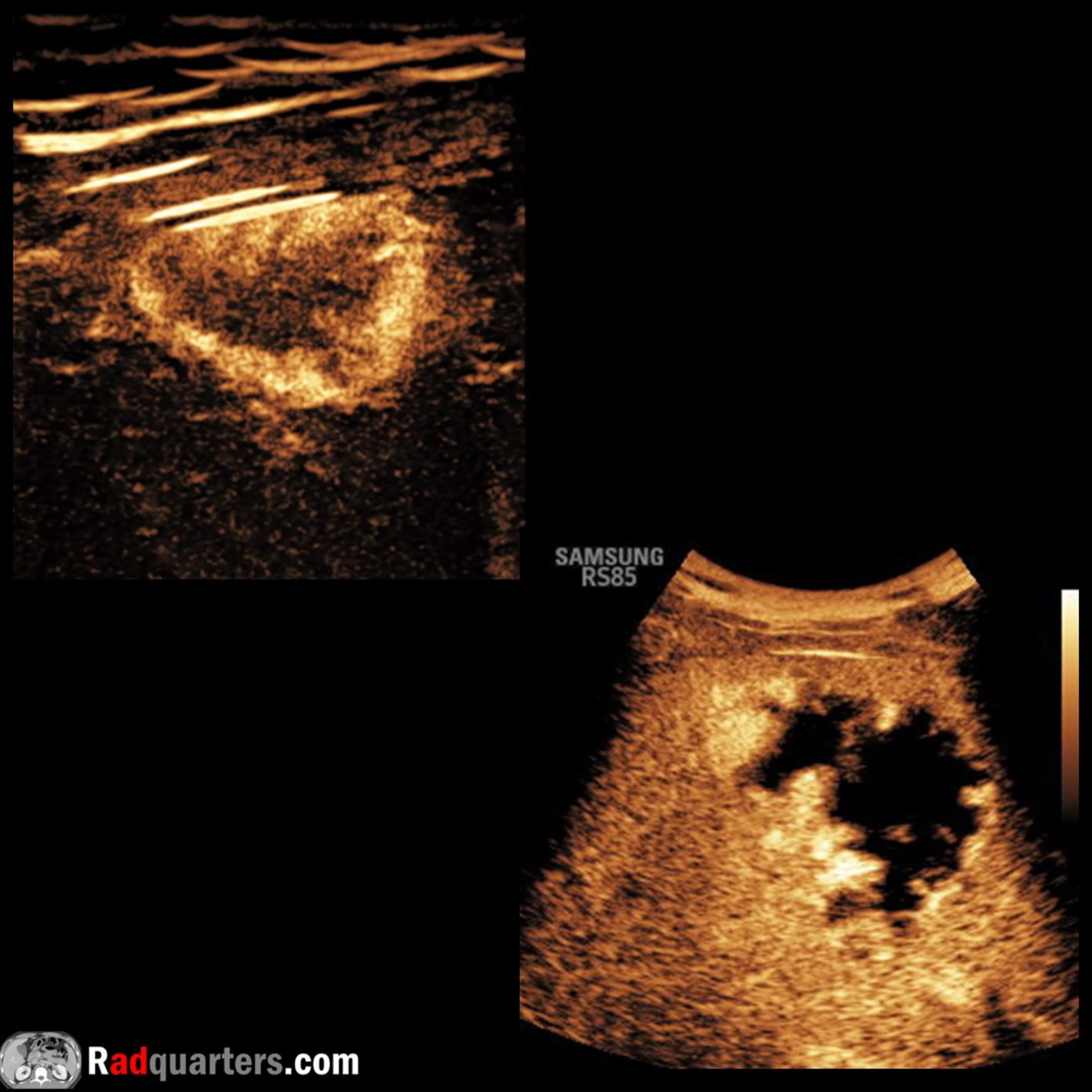 Radiology Lectures | Radquarters