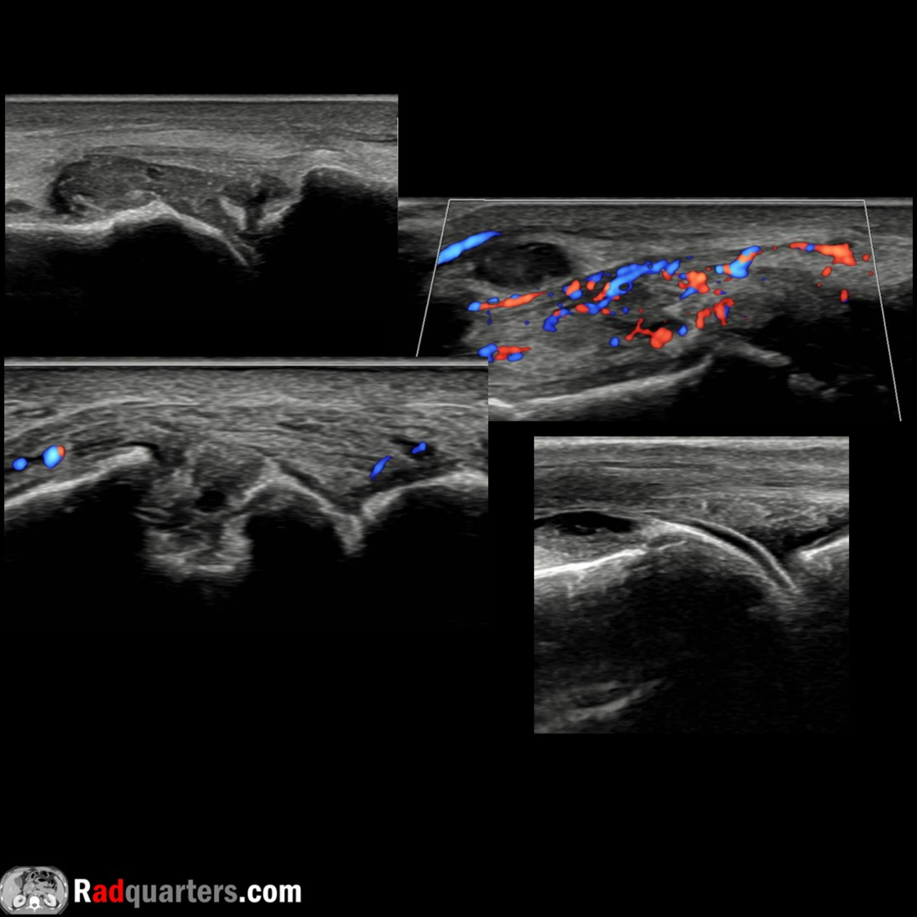 Radiology Lectures | Radquarters
