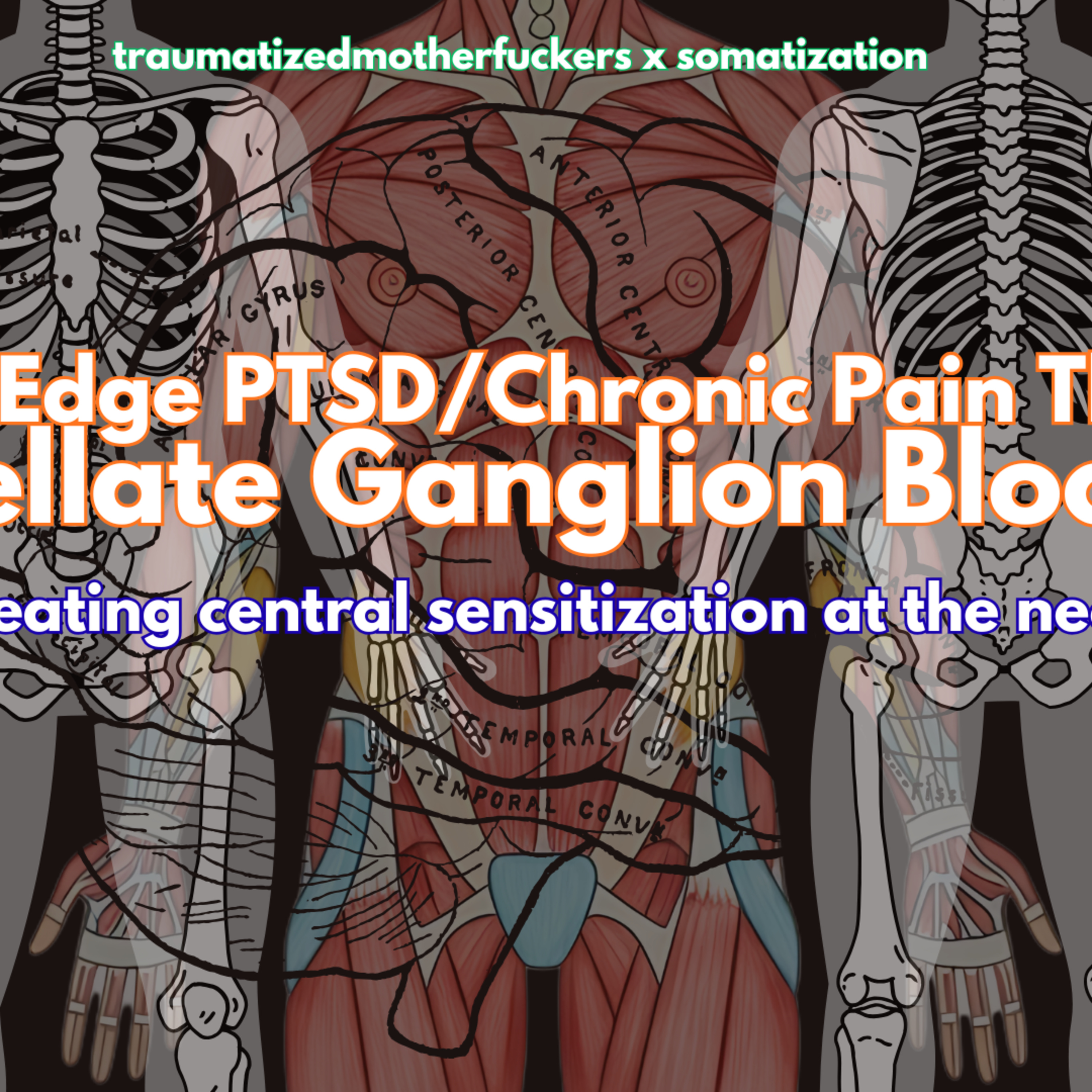 pub pod 6.7 Stellate Ganglion Blocks episode artwork