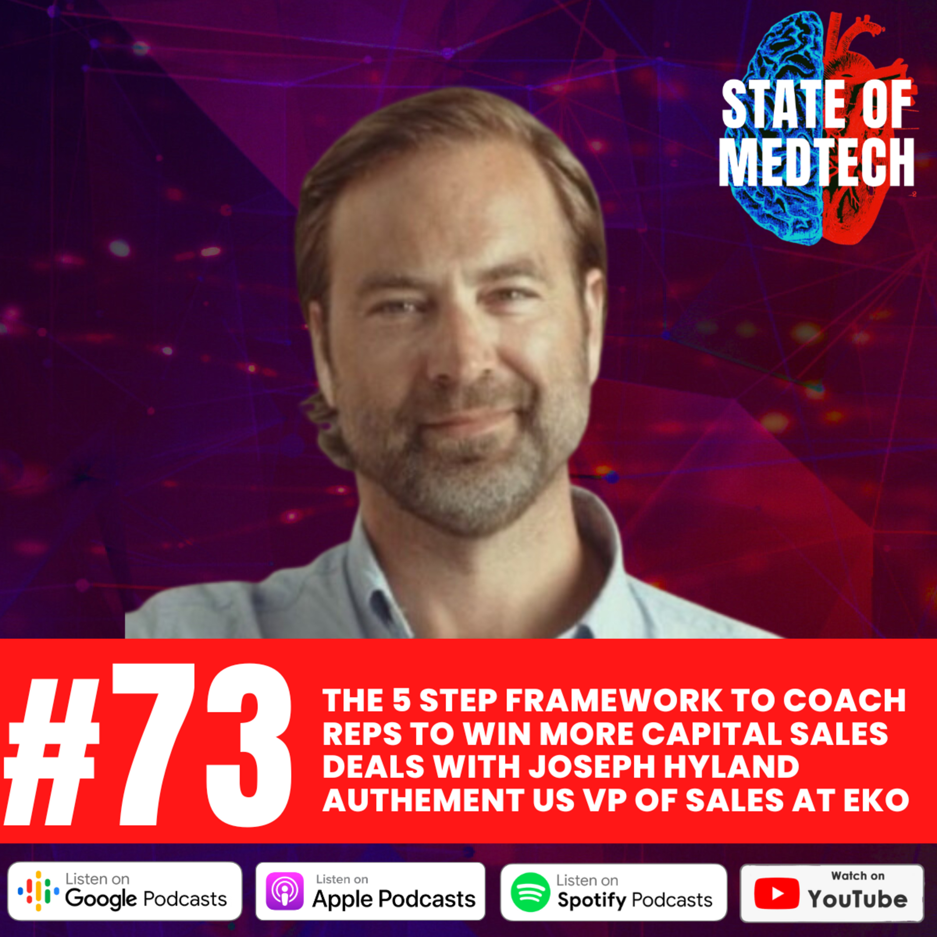 73. Capital Sales: The 5 Step Framework to Coaching Reps to Win More Deals with Joseph Hyland Authement US VP of Sales at Eko episode artwork