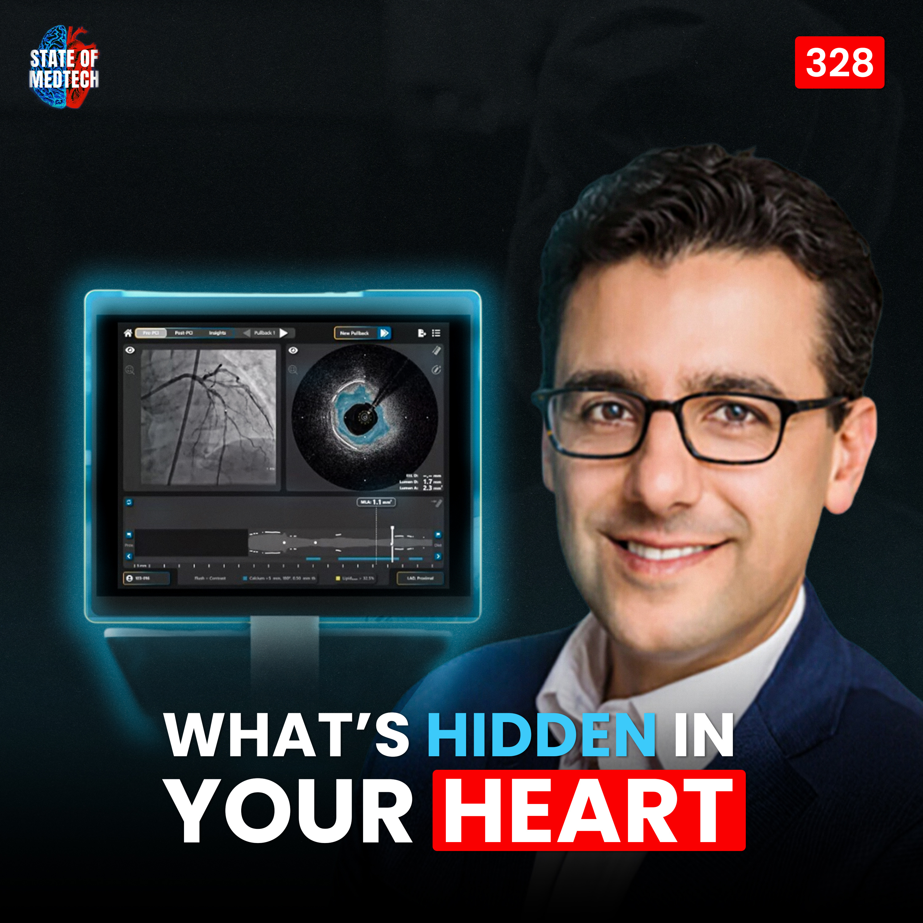 328. Cardio: How AI & Deep Tech Are Transforming Cardiac Care with Eman Namati CEO at SpectraWAVE episode artwork
