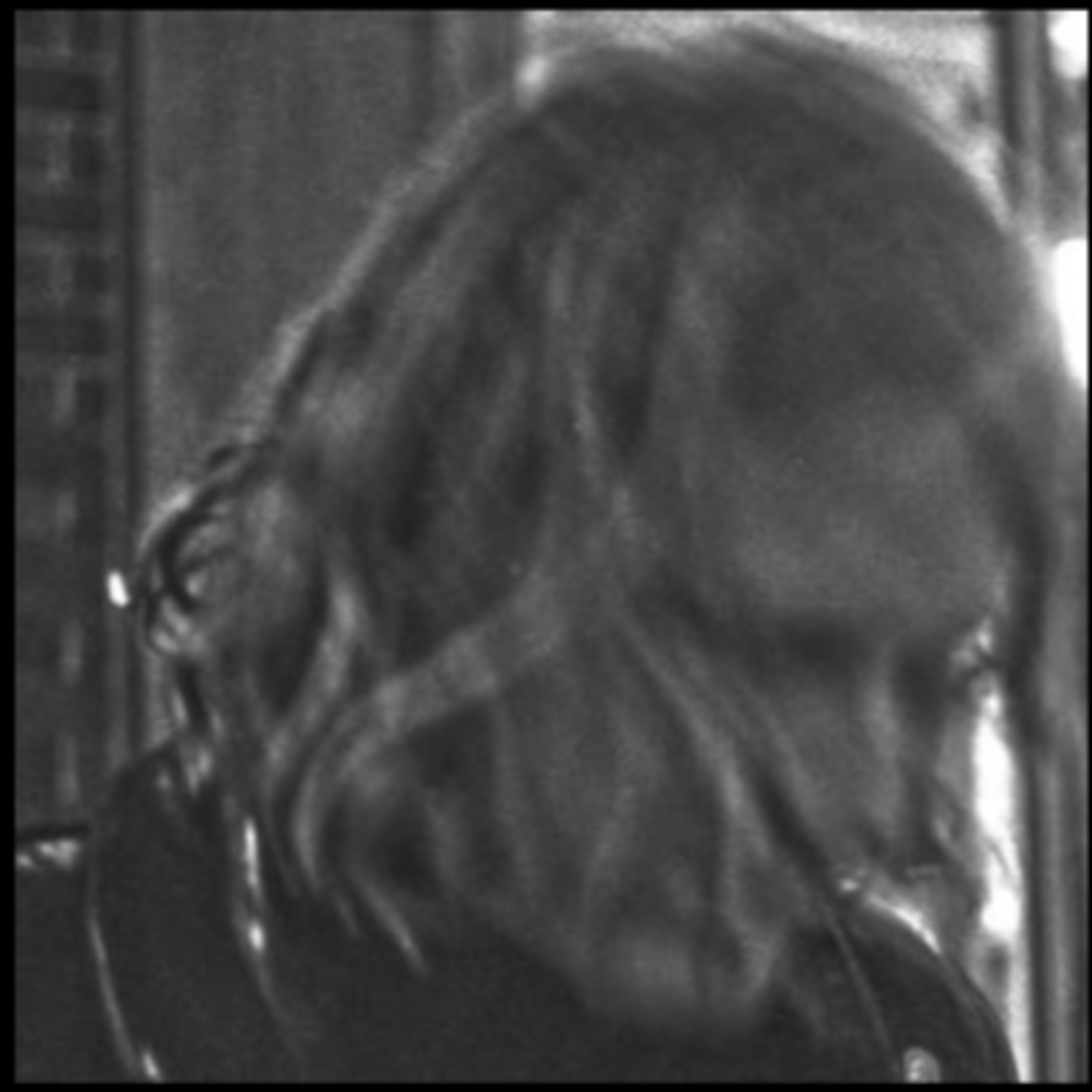 🎙️CWT603: Ty Segall (2017) ALBUM REVIEW episode artwork