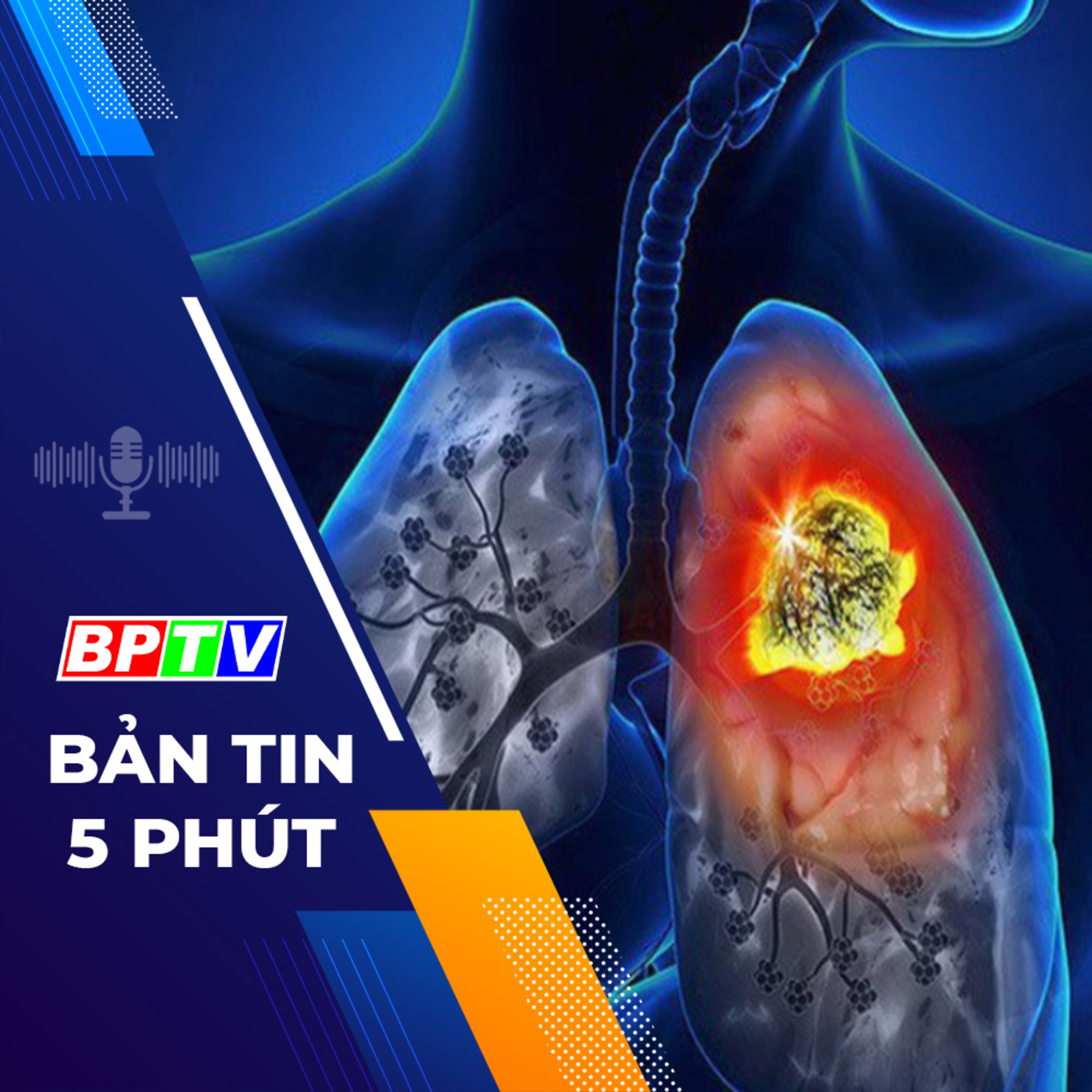 5 phút sáng nay 6-1-2024 episode artwork