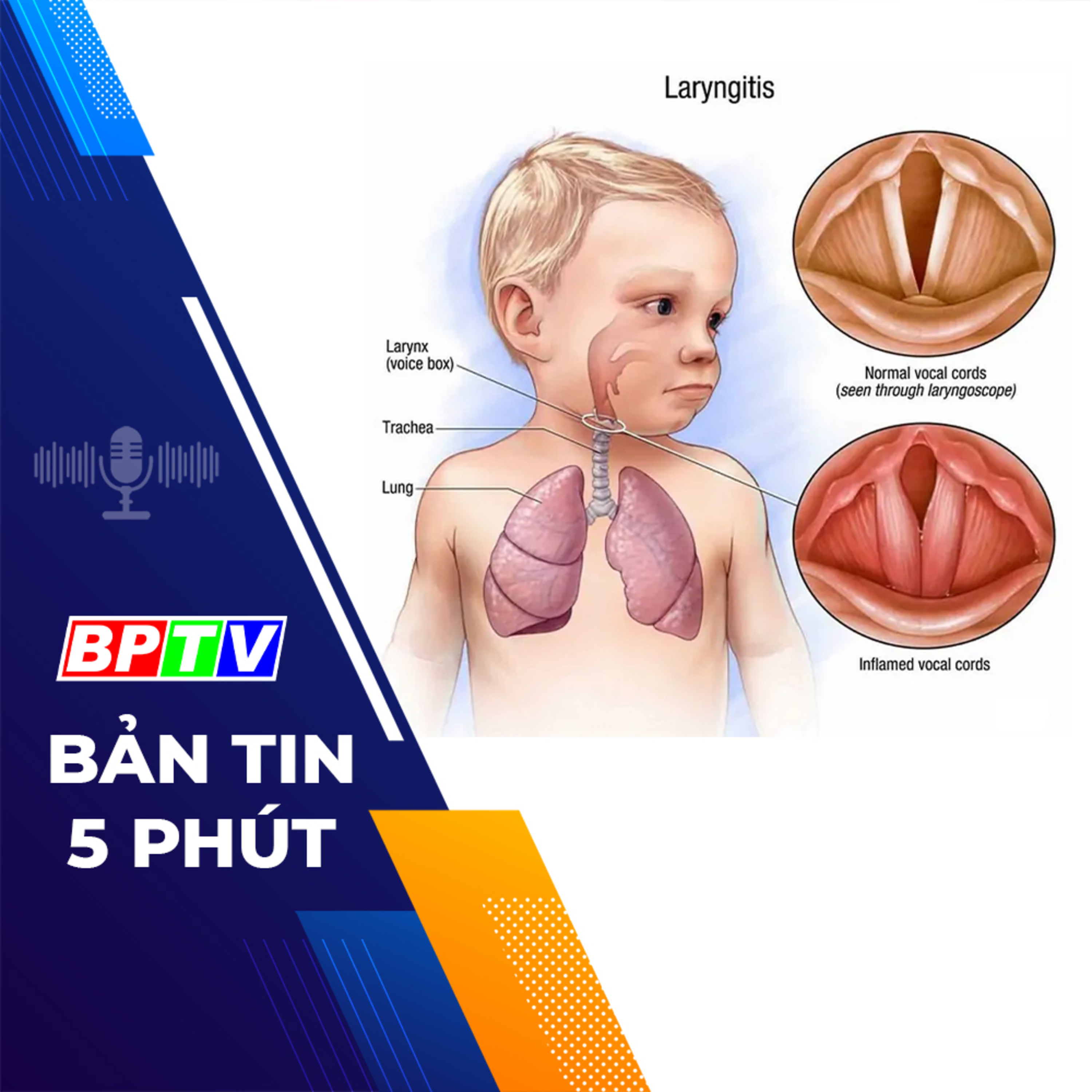5 phút sáng nay 28-2-2024 episode artwork