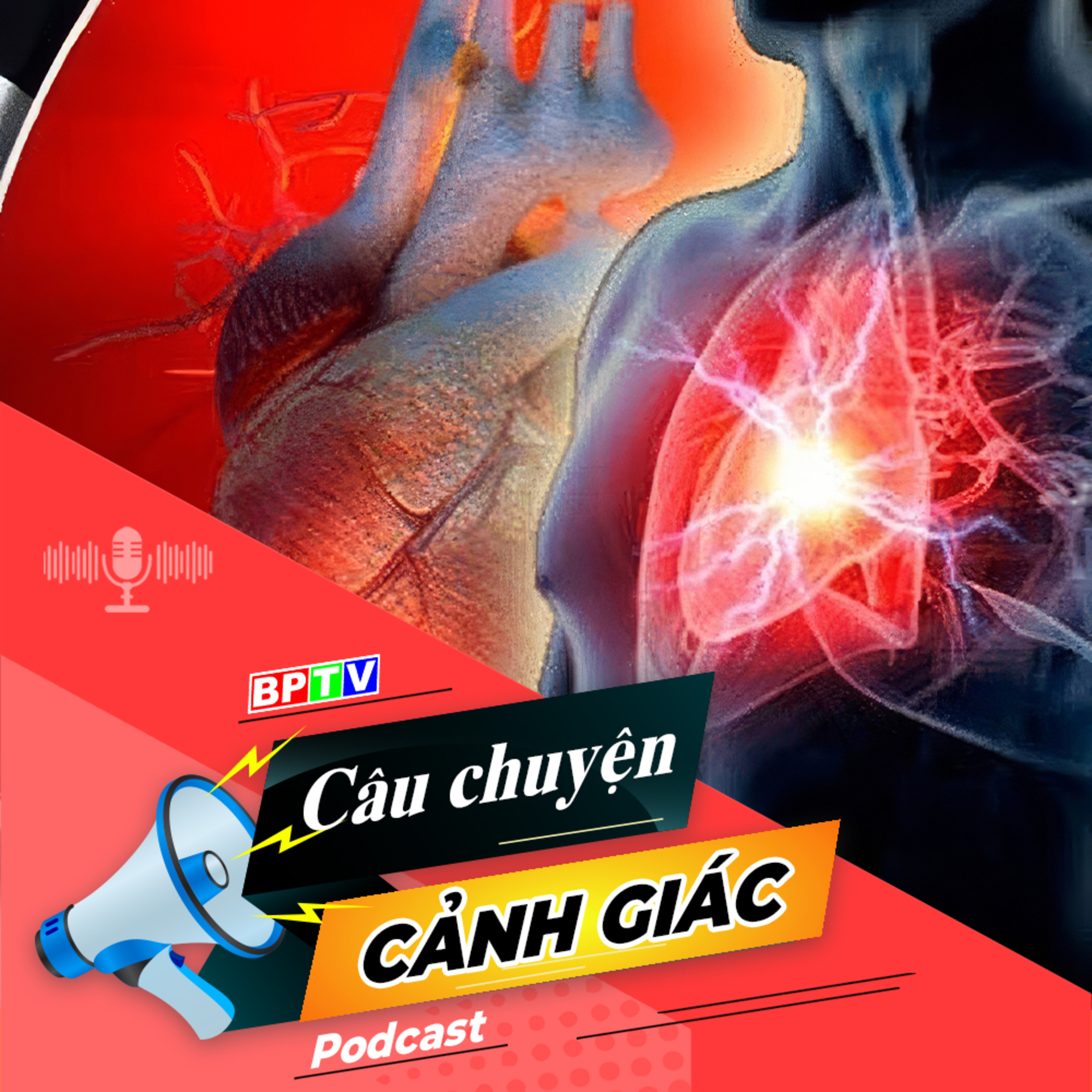 Cảnh giác với bệnh nhồi máu cơ tim cấp (đột quỵ tim) | Câu chuyện cảnh giác episode artwork
