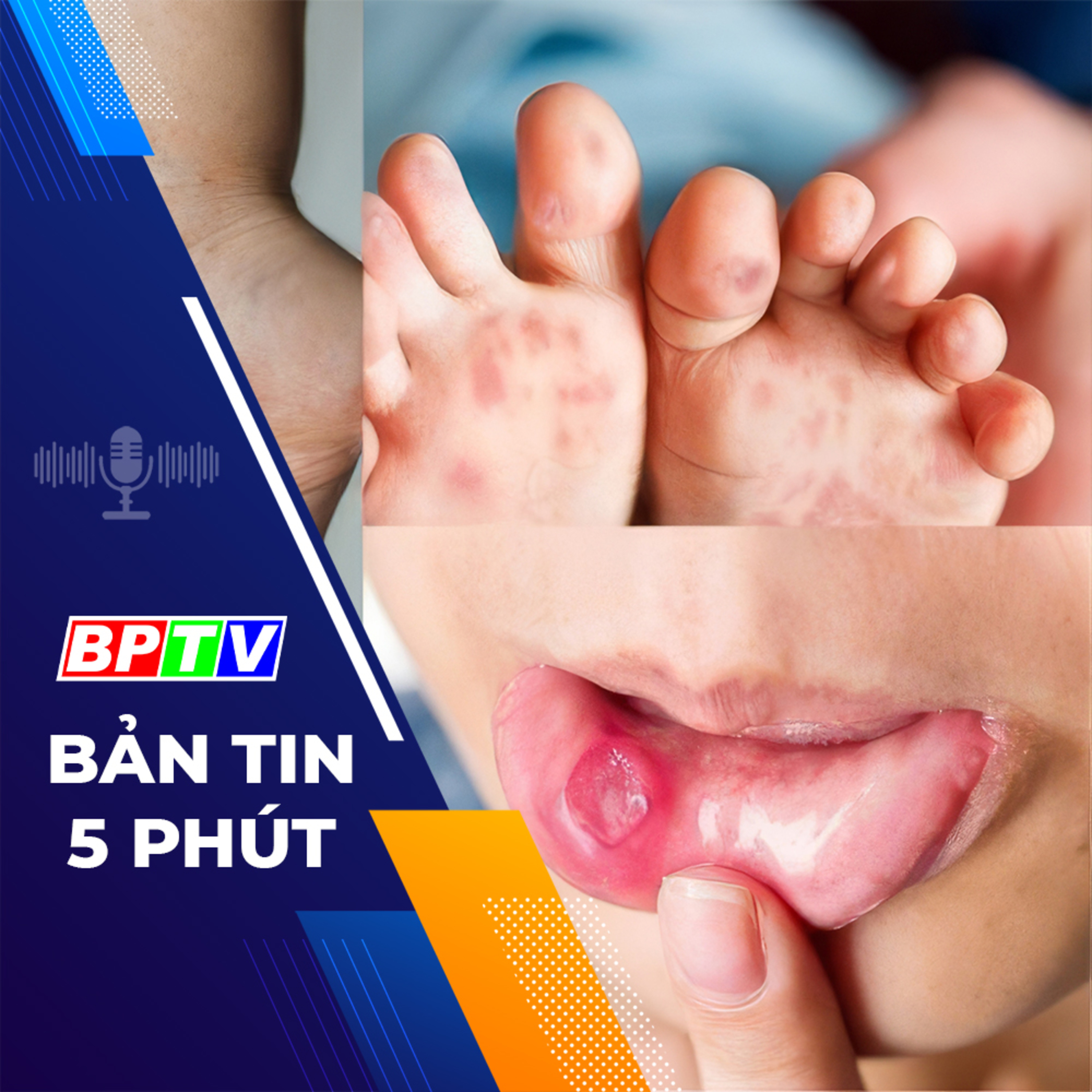 5 phút trưa nay 12-4-2024 episode artwork