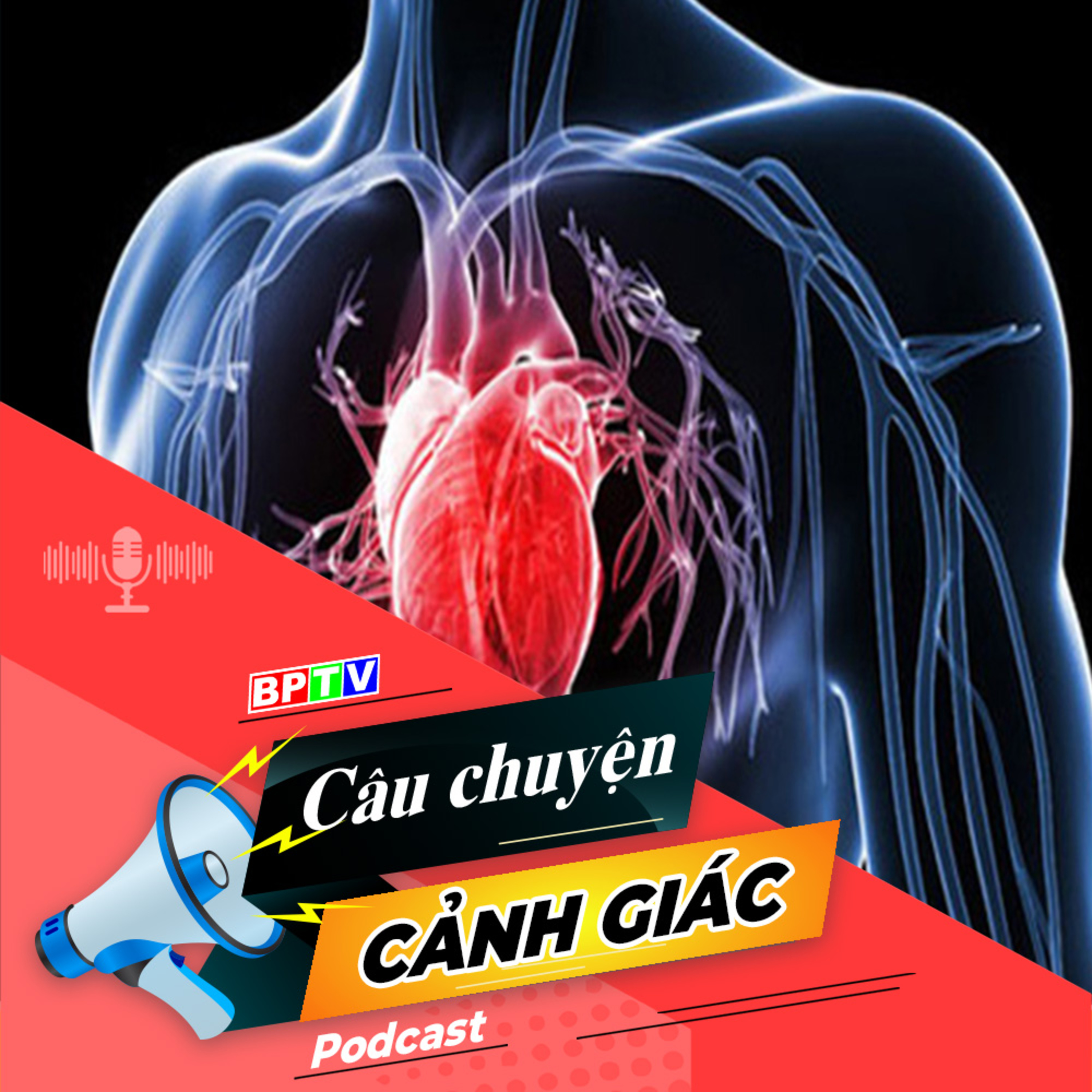 Cảnh giác với bệnh mạch vành | Câu chuyện cảnh giác episode artwork