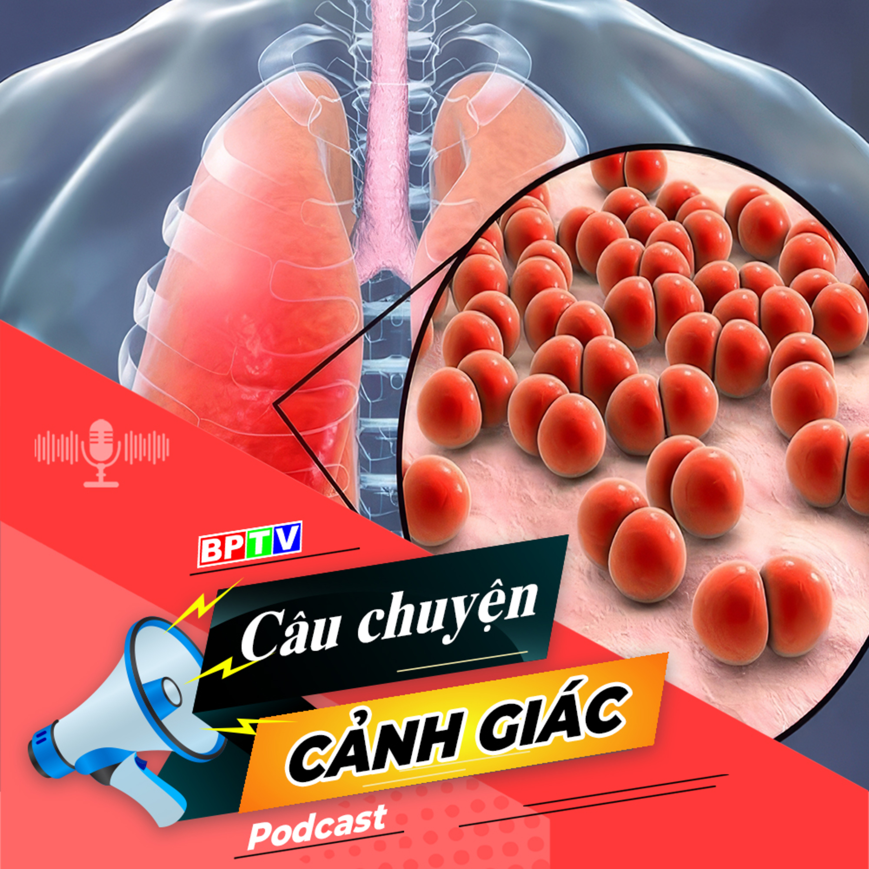 Cẩn trọng với bệnh nấm phổi | Câu chuyện cảnh giác episode artwork