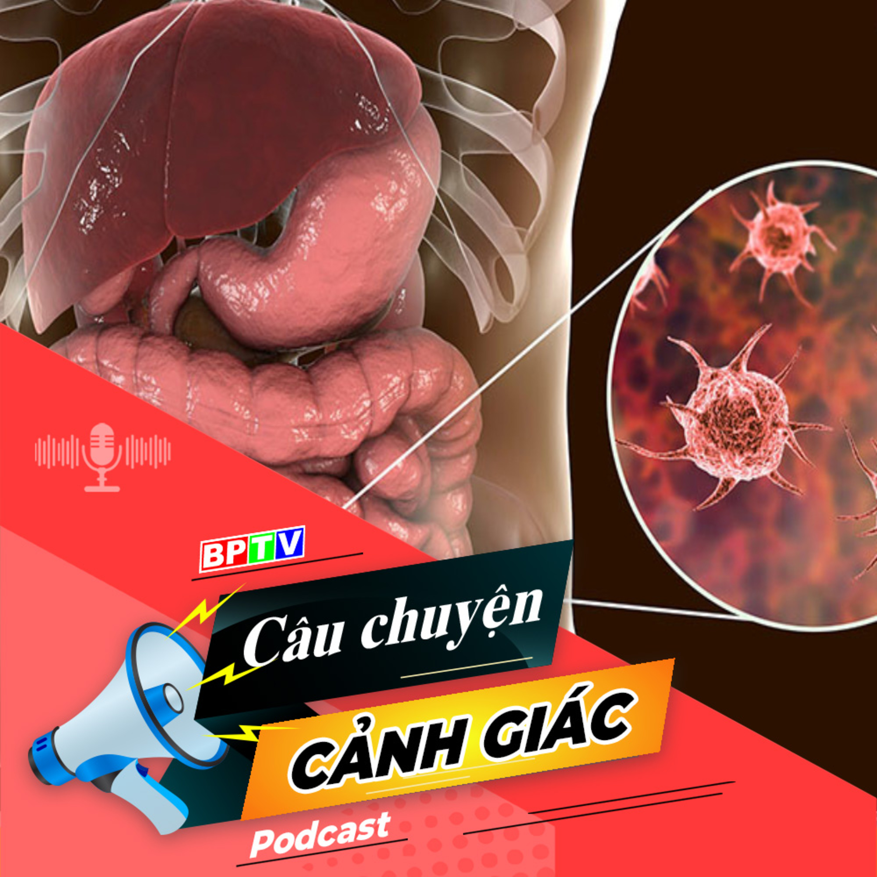 Cảnh giác với bệnh lỵ trực khuẩn (lỵ trực trùng) | Câu chuyện cảnh giác episode artwork