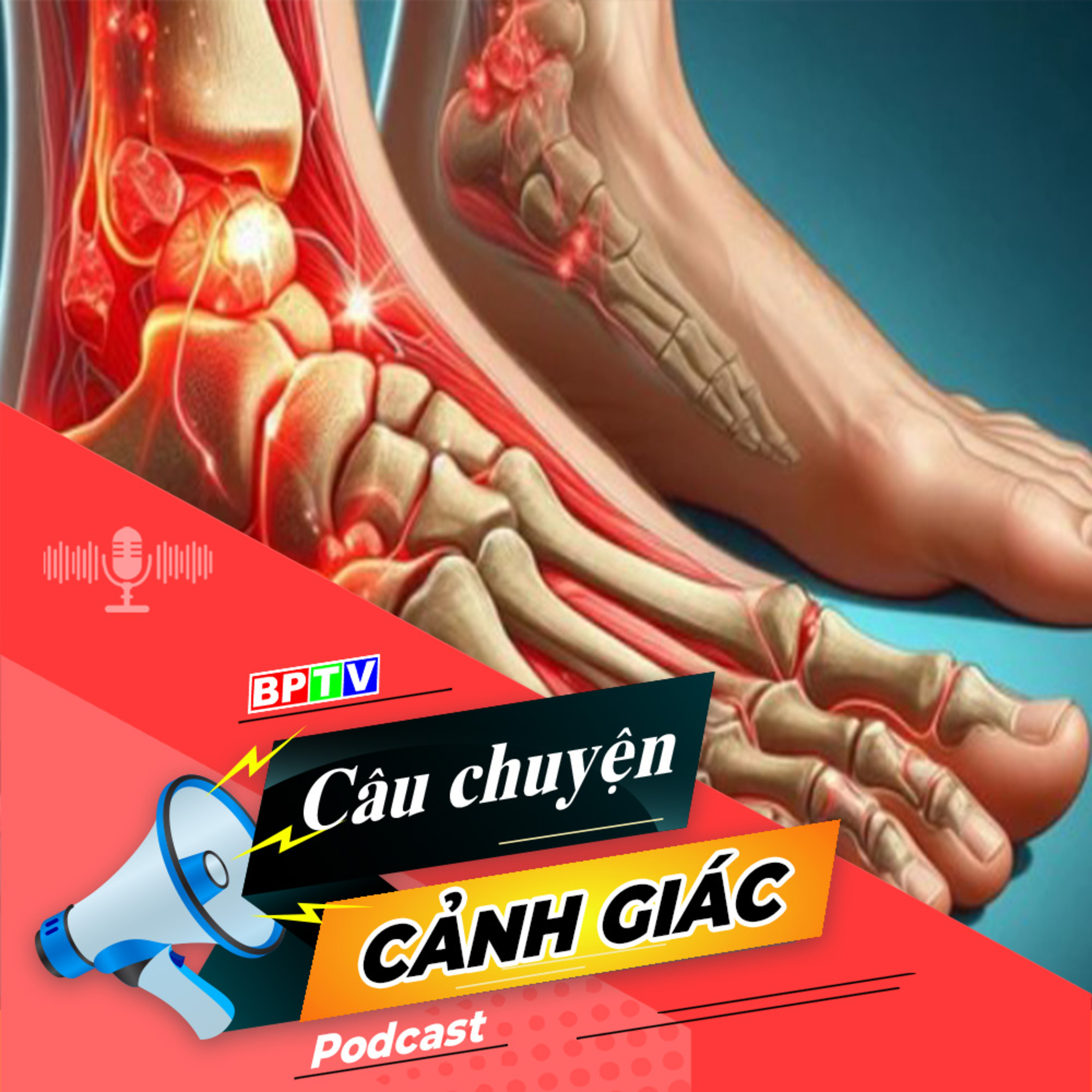 Cảnh giác với bệnh gout (bệnh thống phong) | Câu chuyện cảnh giác episode artwork