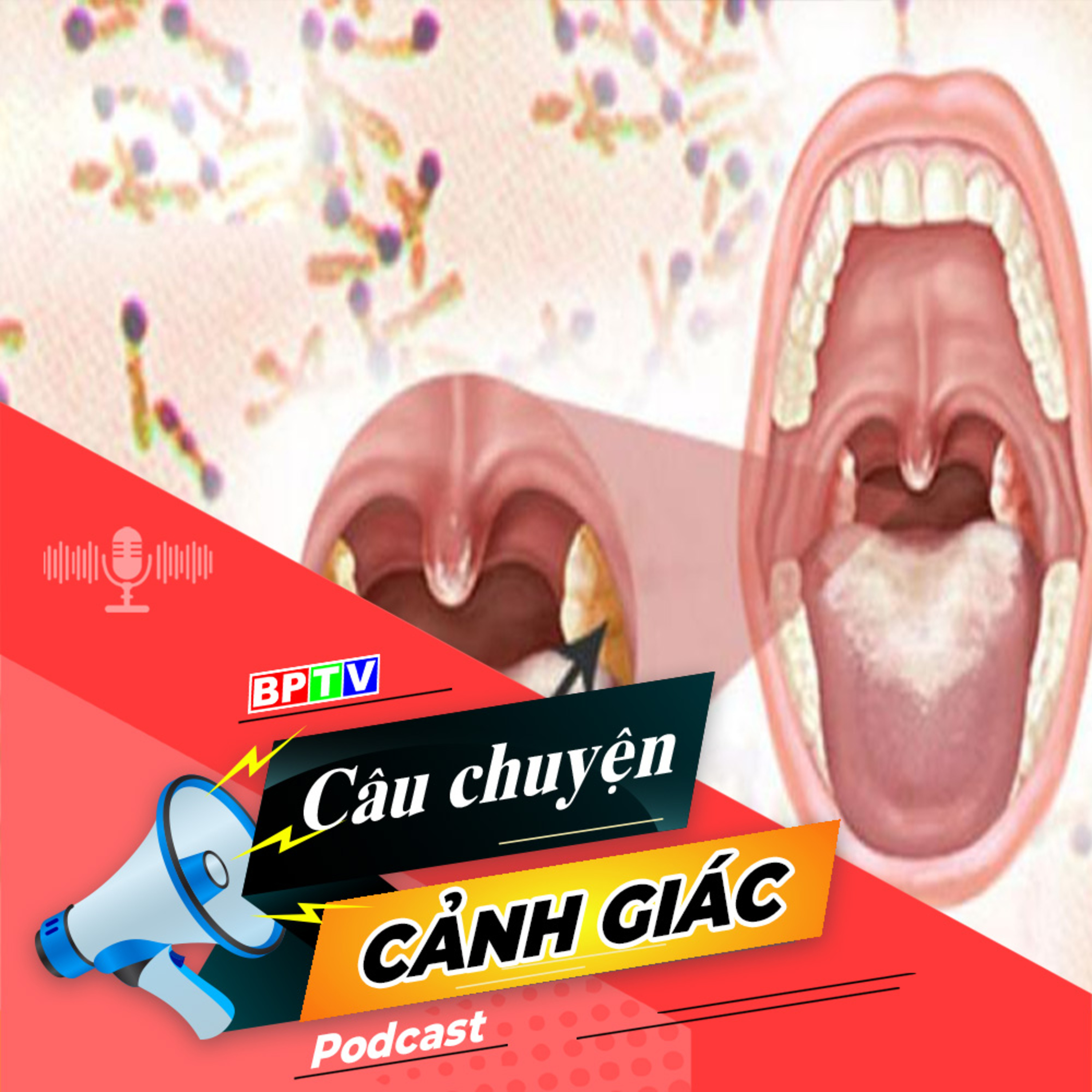Cảnh giác với bệnh bạch hầu | Câu chuyện cảnh giác episode artwork