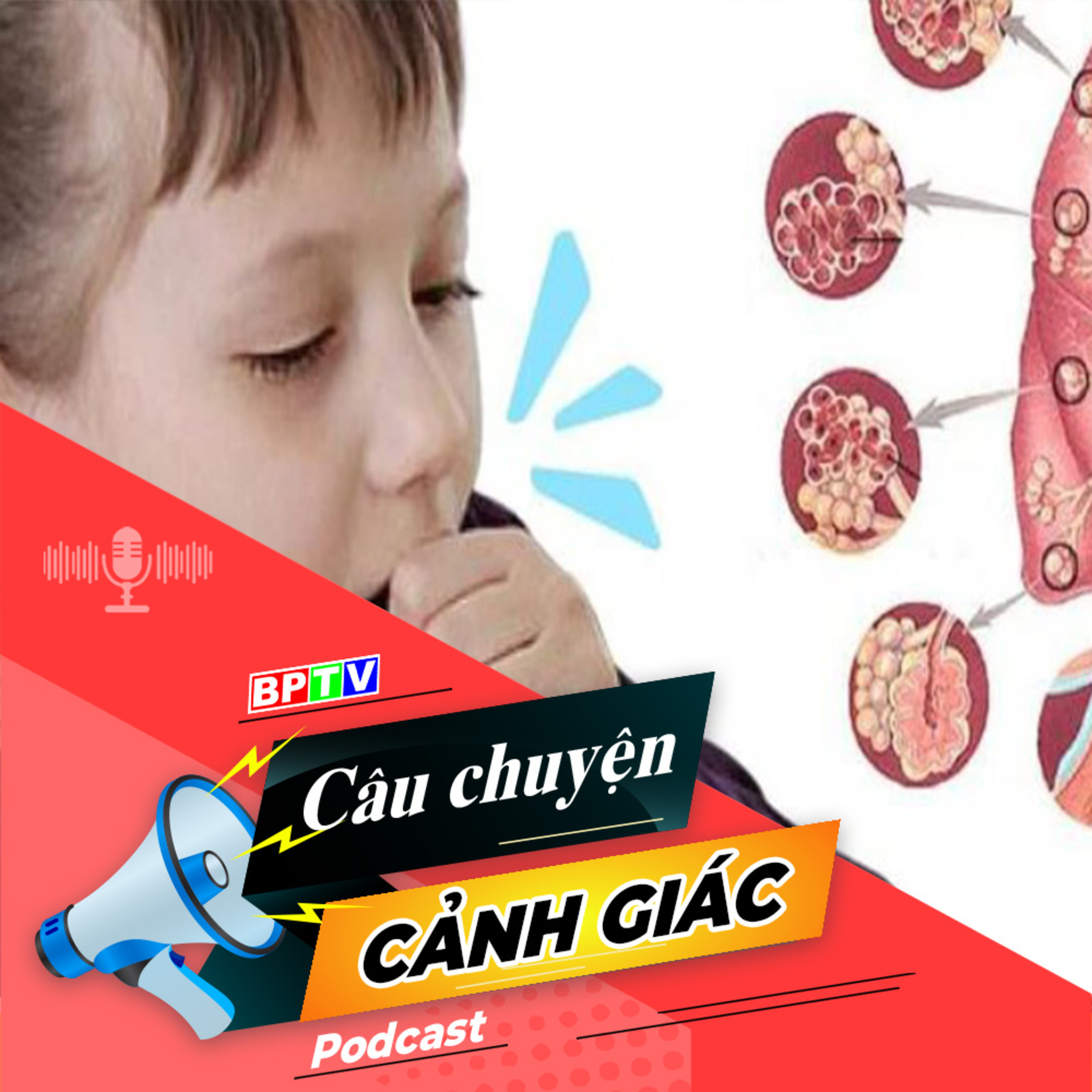 Cảnh giác với bệnh ho gà ở trẻ | Câu chuyện cảnh giác episode artwork