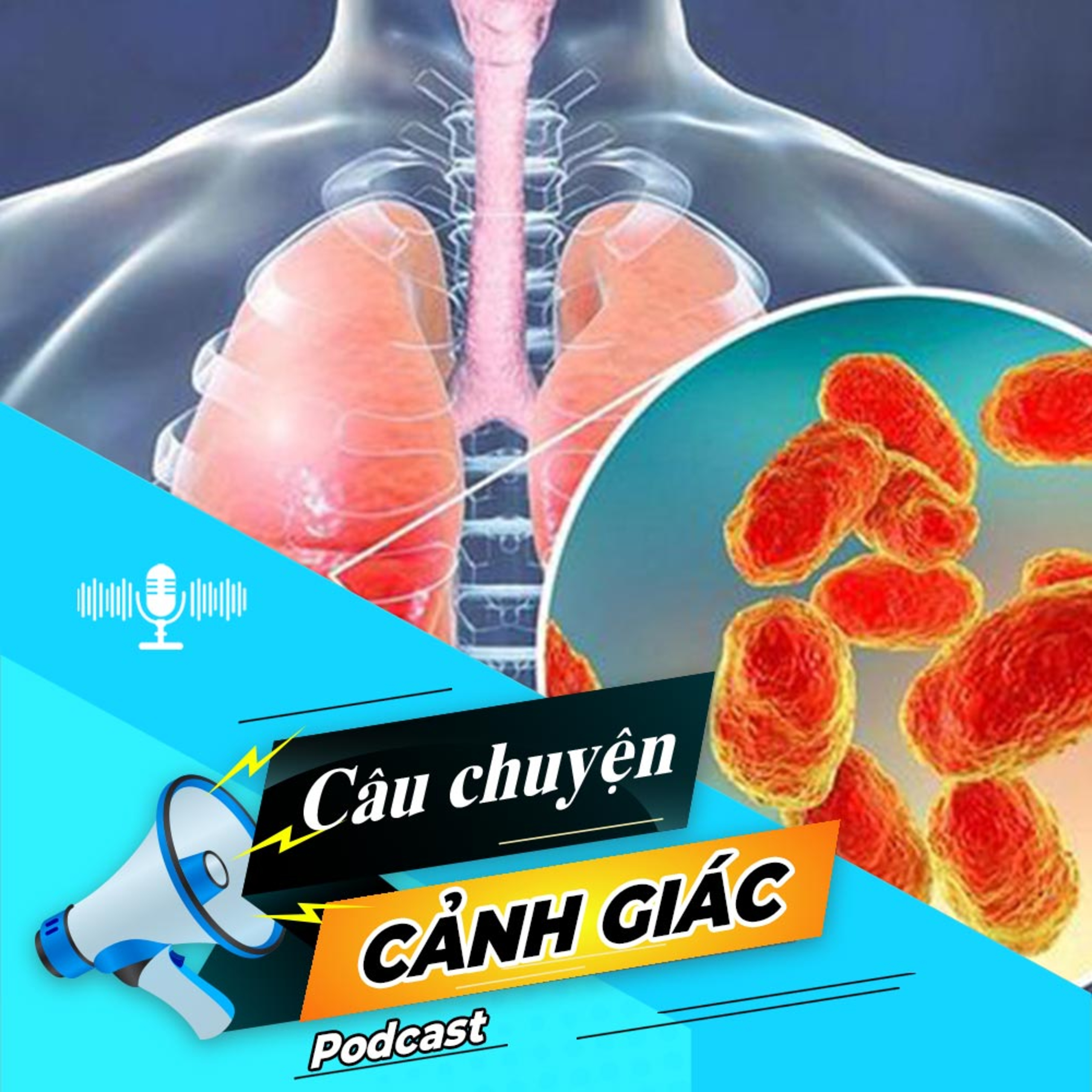 Cảnh giác với bệnh viêm tiểu phế quản ở trẻ | Câu chuyện cảnh giác episode artwork