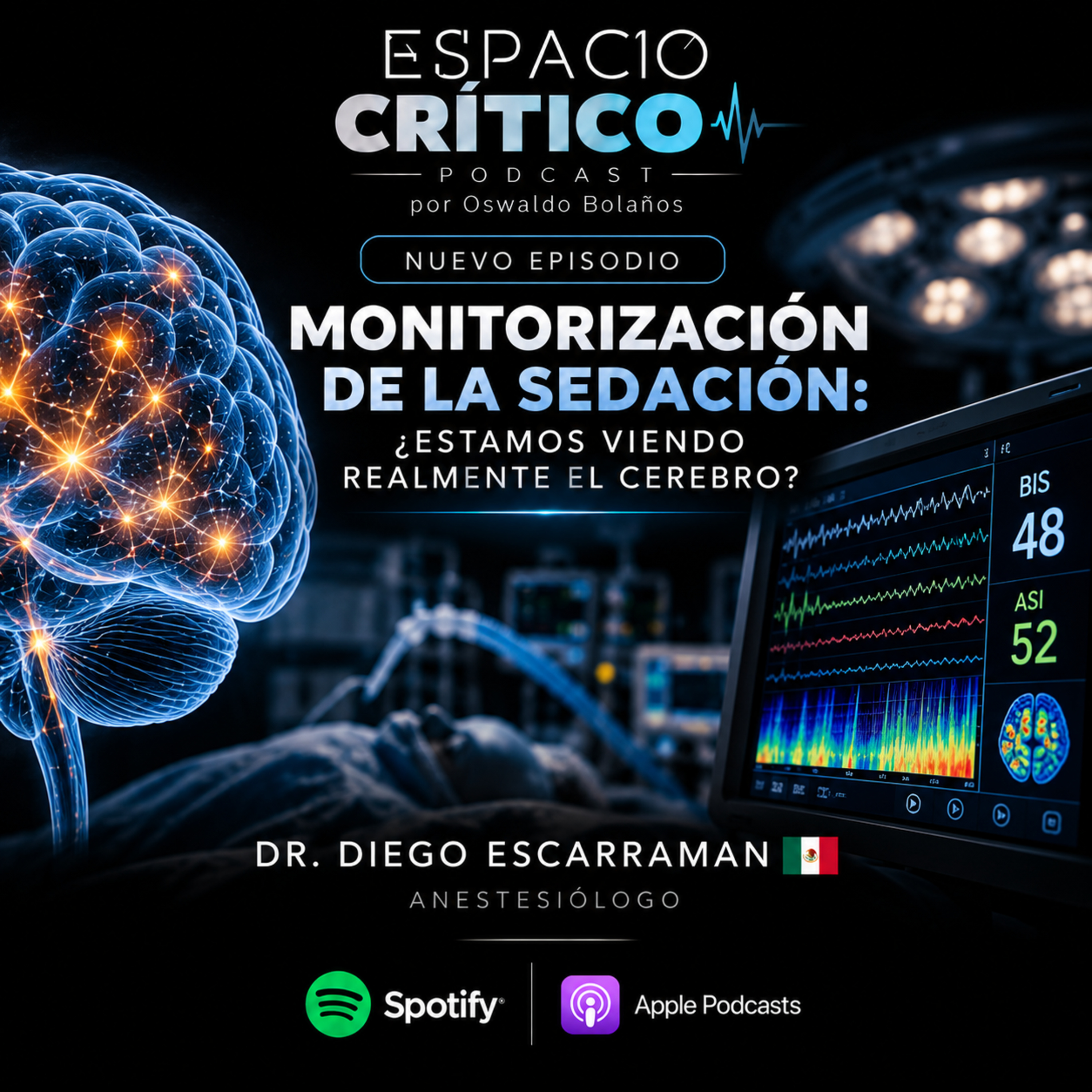 Monitorización de la sedación ! Estamos viendo realmente el cerebro ?