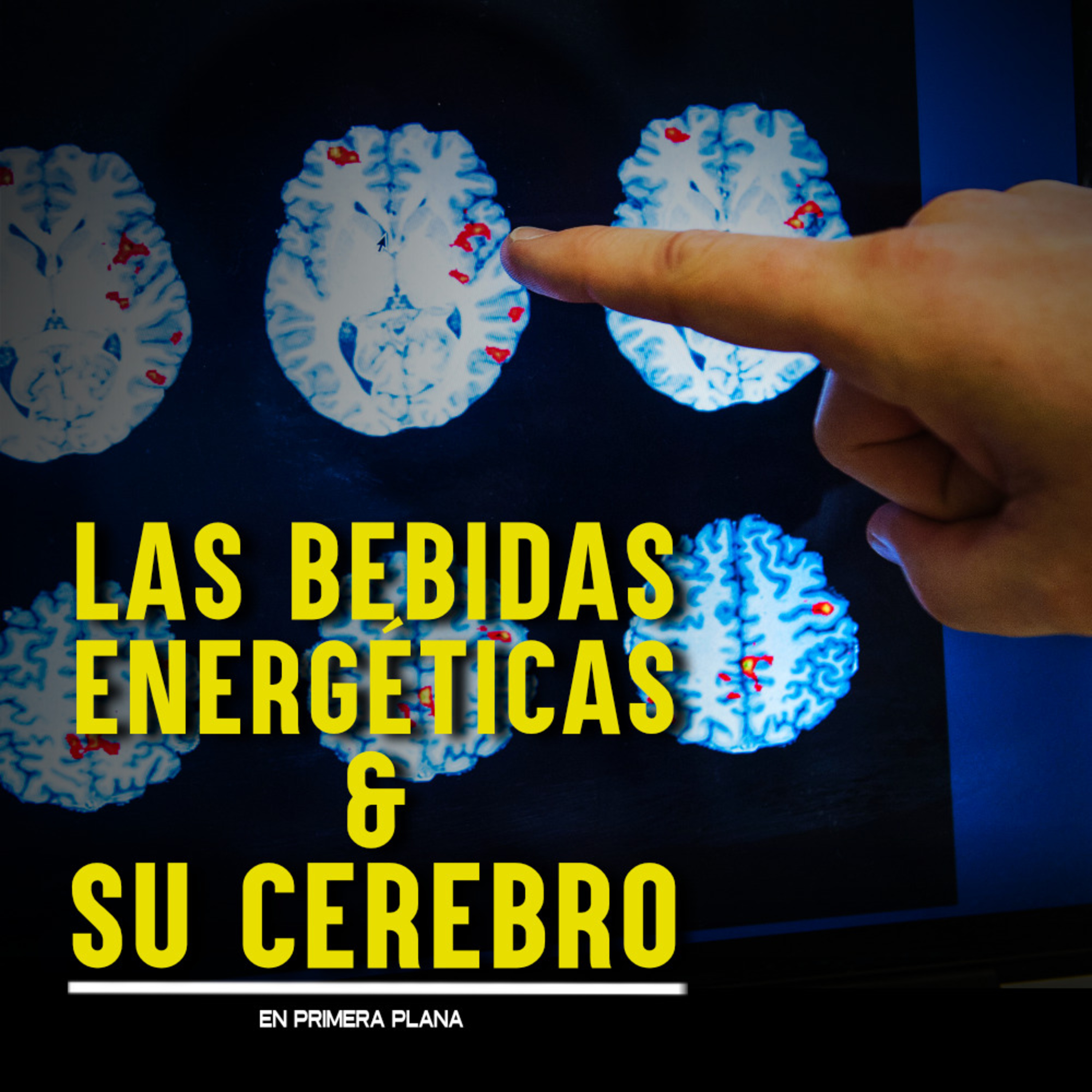 ¿Las bebidas energéticas pueden estar agotando la energía de su cerebro? episode artwork