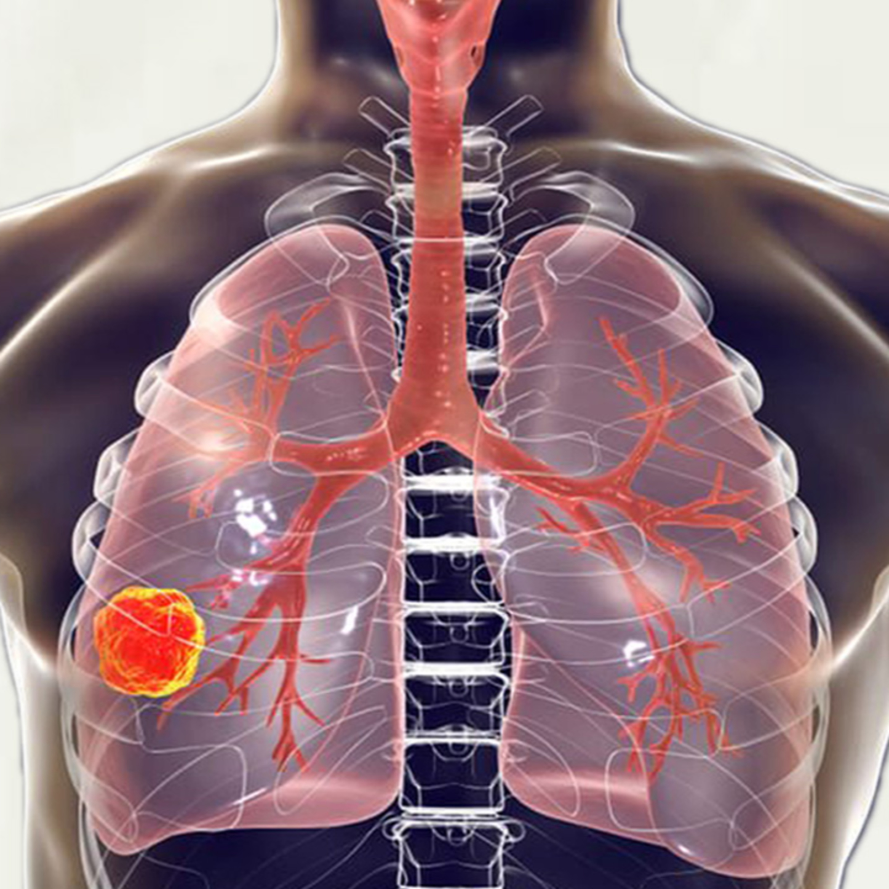 Cada 24 de marzo, se conmemora el Día Mundial de la Tuberculosis  episode artwork