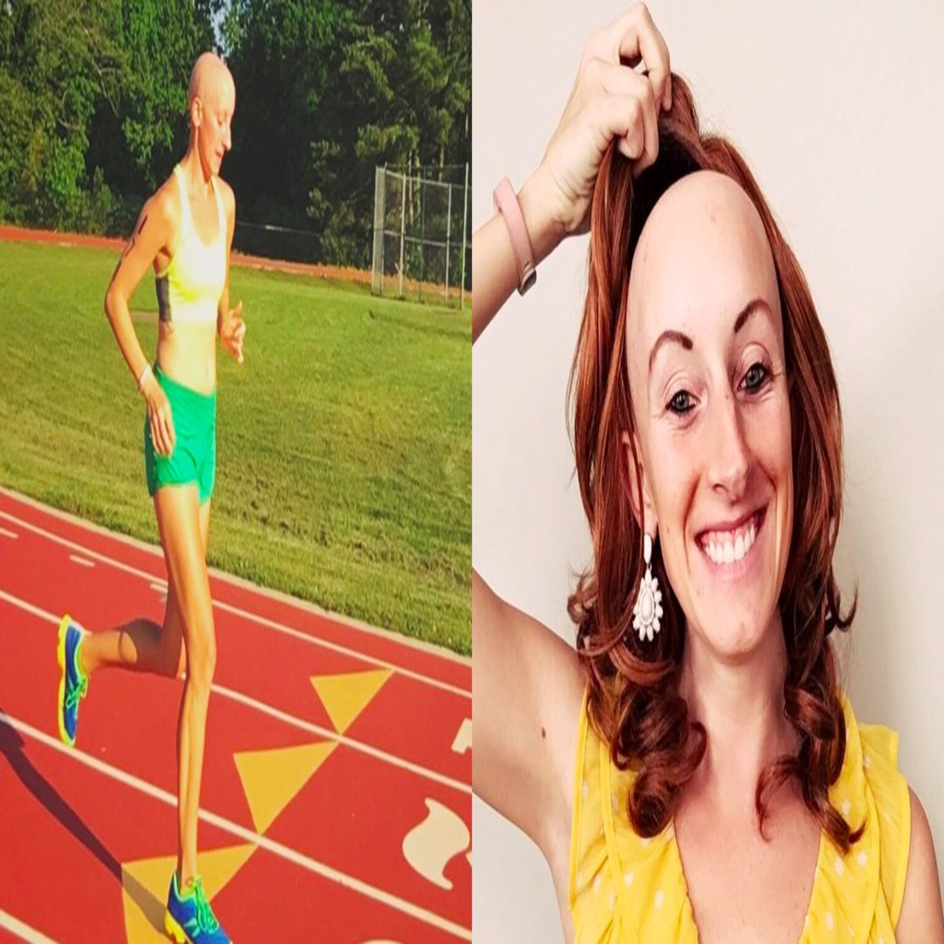 Episode 26: Lindsay Walter on Alopecia and Running