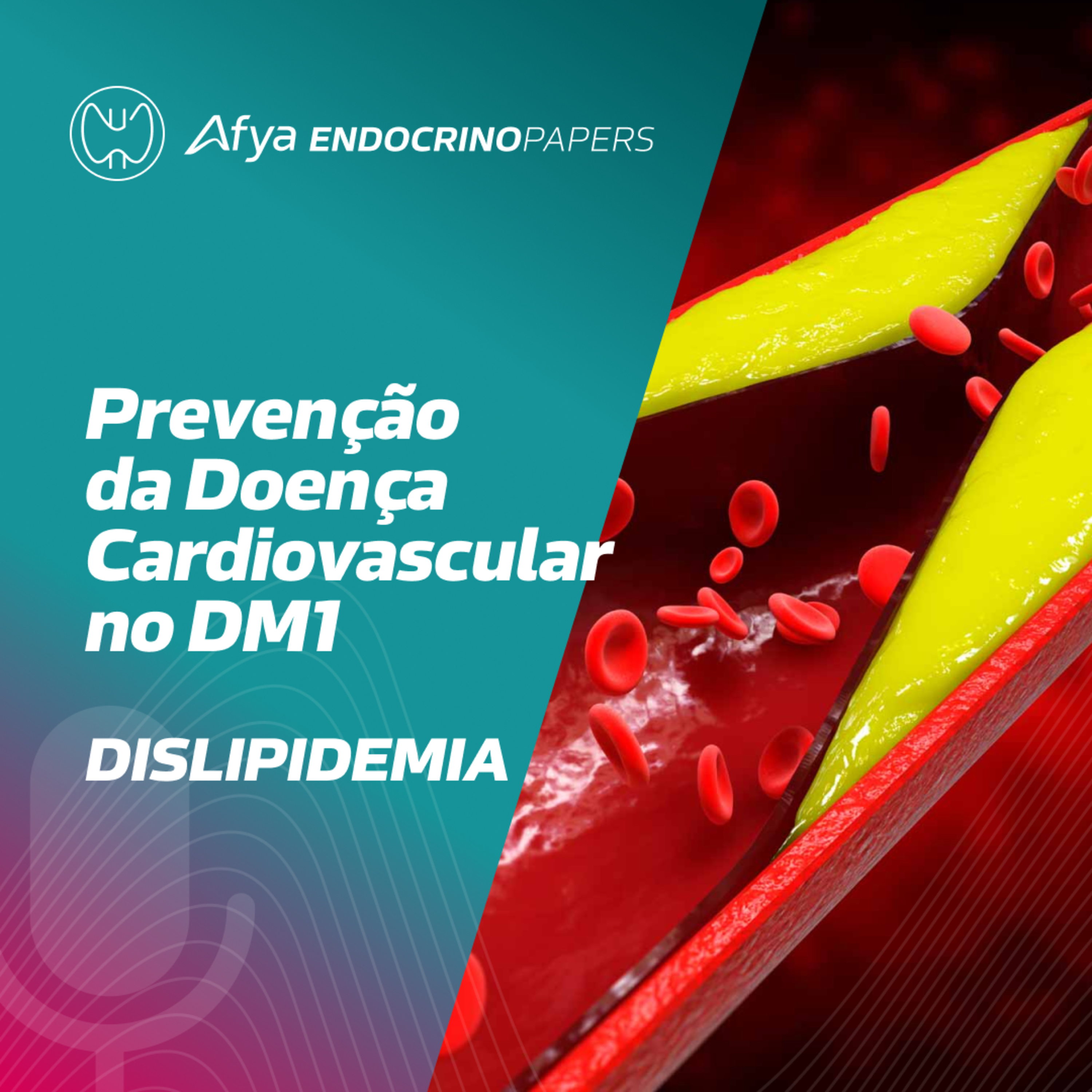 Como abordar a dislipidemia em pacientes com diabetes mellitus tipo 1? episode artwork