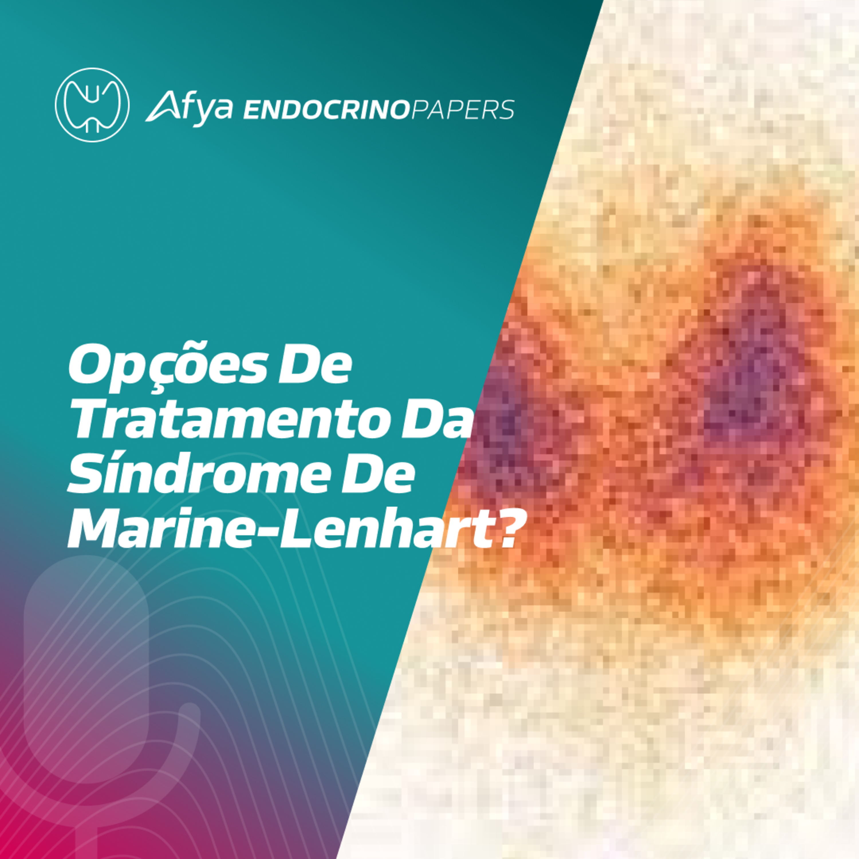 Quais são as opções de tratamento para pacientes portadores da síndrome de Marine-Lenhart? episode artwork