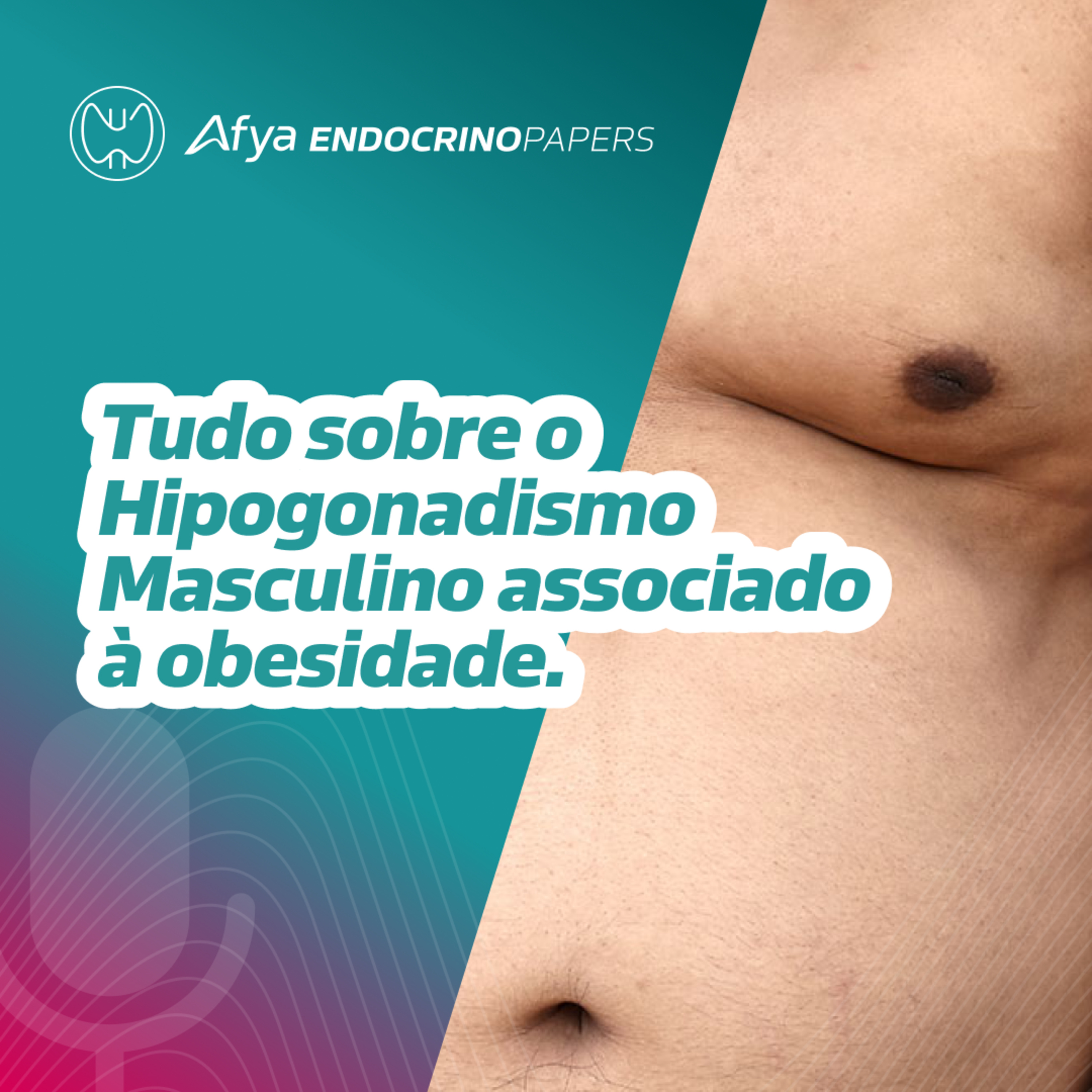 Tudo sobre Hipogonadismo Masculino Associado à Obesidade episode artwork