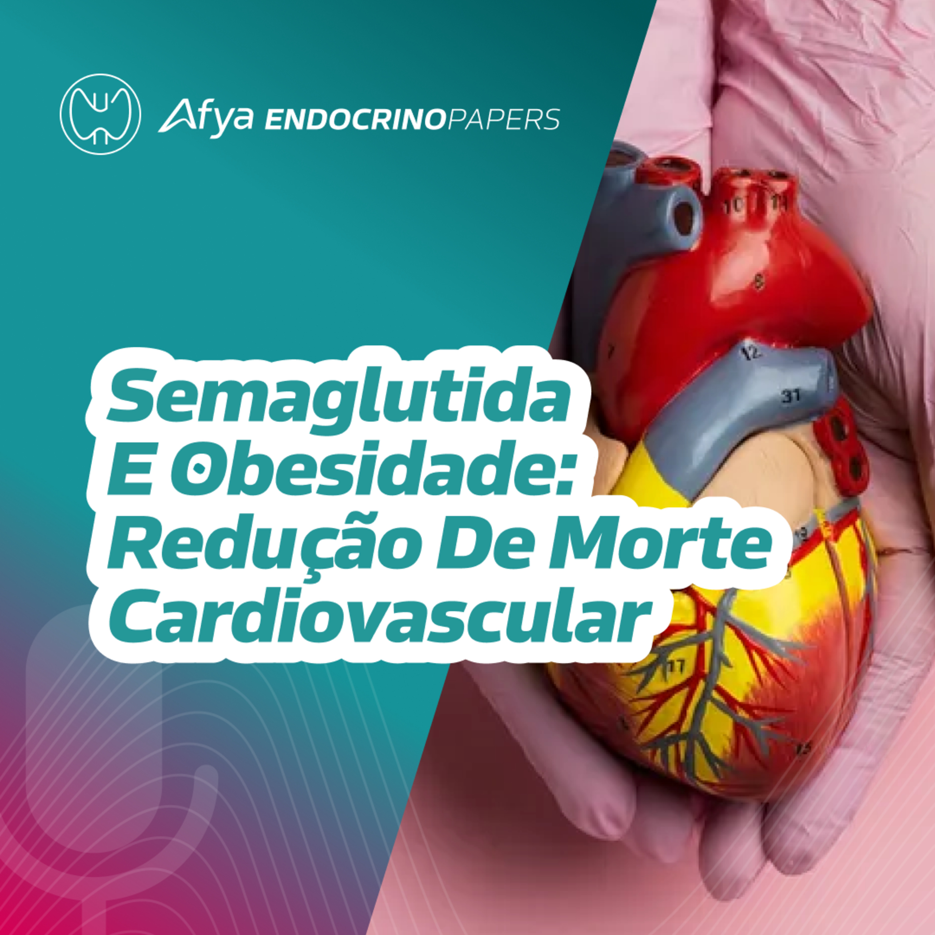 Há redução de mortalidade cardiovascular com o uso da semaglutida para tratamento da obesidade?  episode artwork