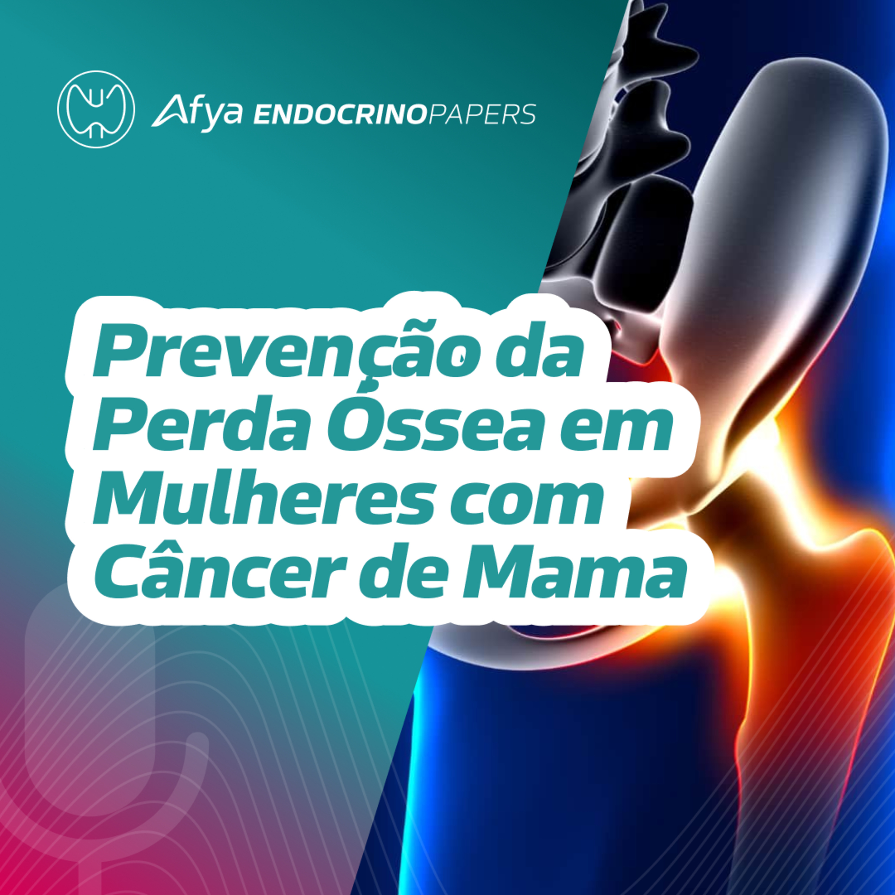 Prevenção da perda óssea em mulheres com câncer de mama episode artwork