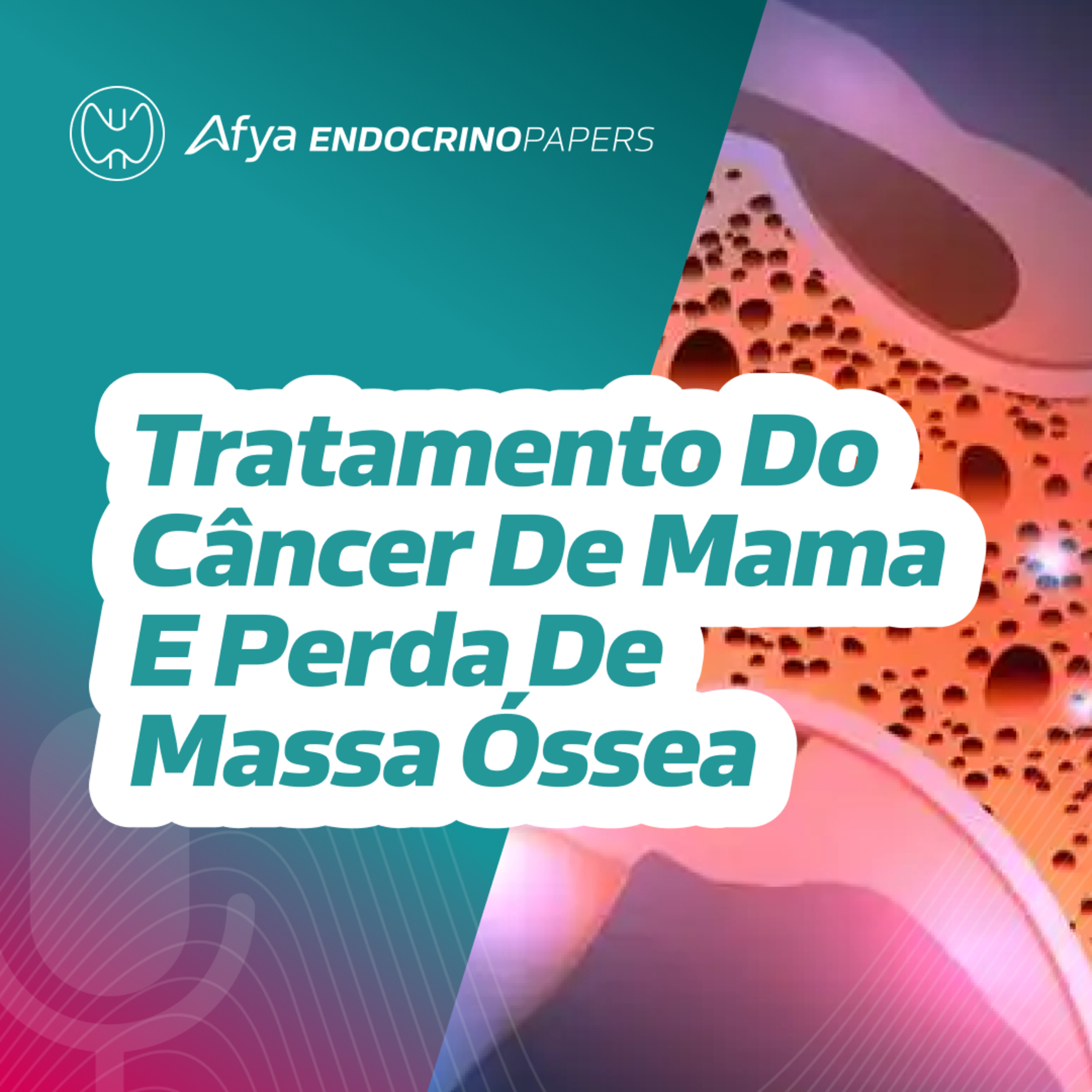 Como as terapias hormonais do câncer de mama causam perda de massa óssea?  episode artwork