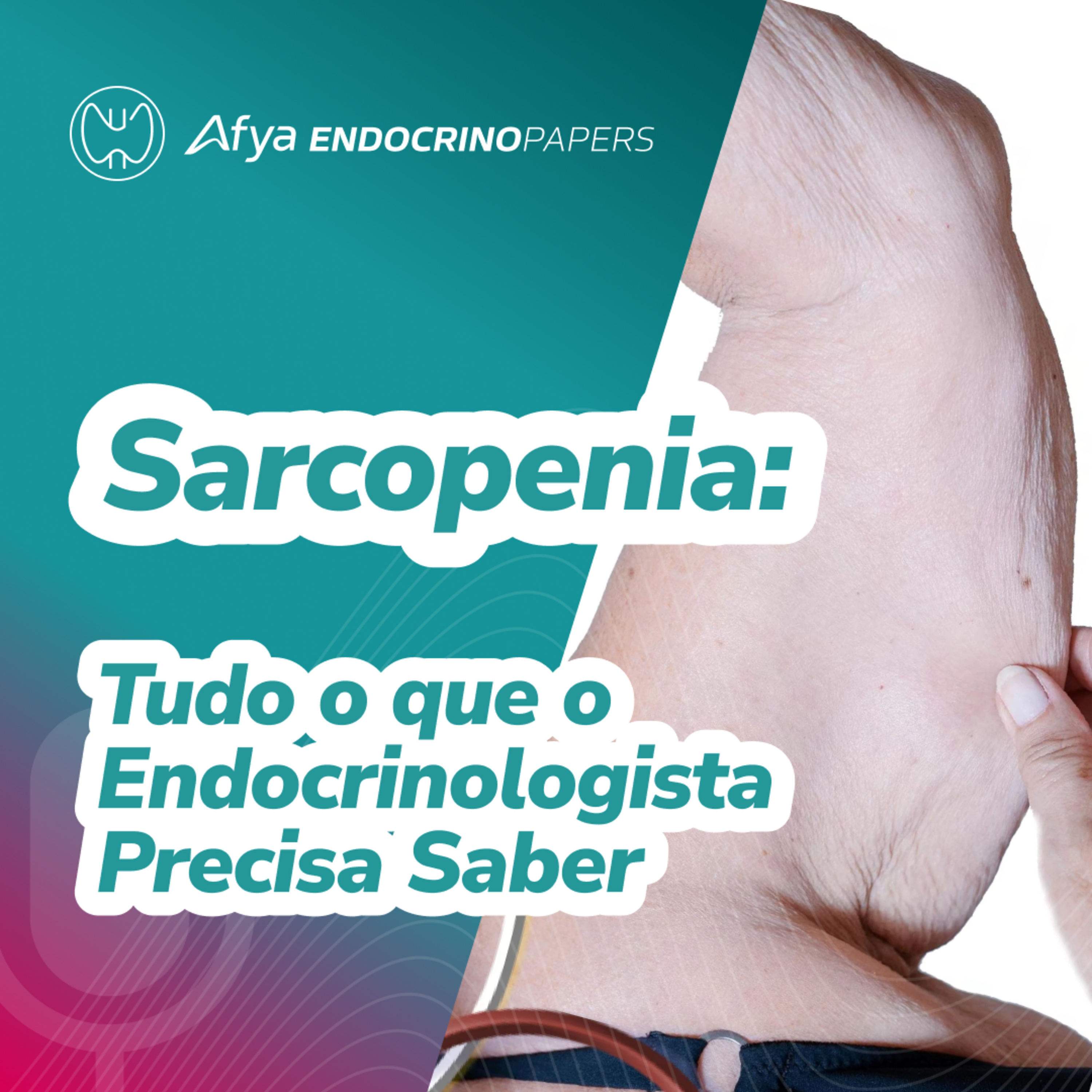 Sarcopenia: tudo o que o endocrinologista precisa saber episode artwork