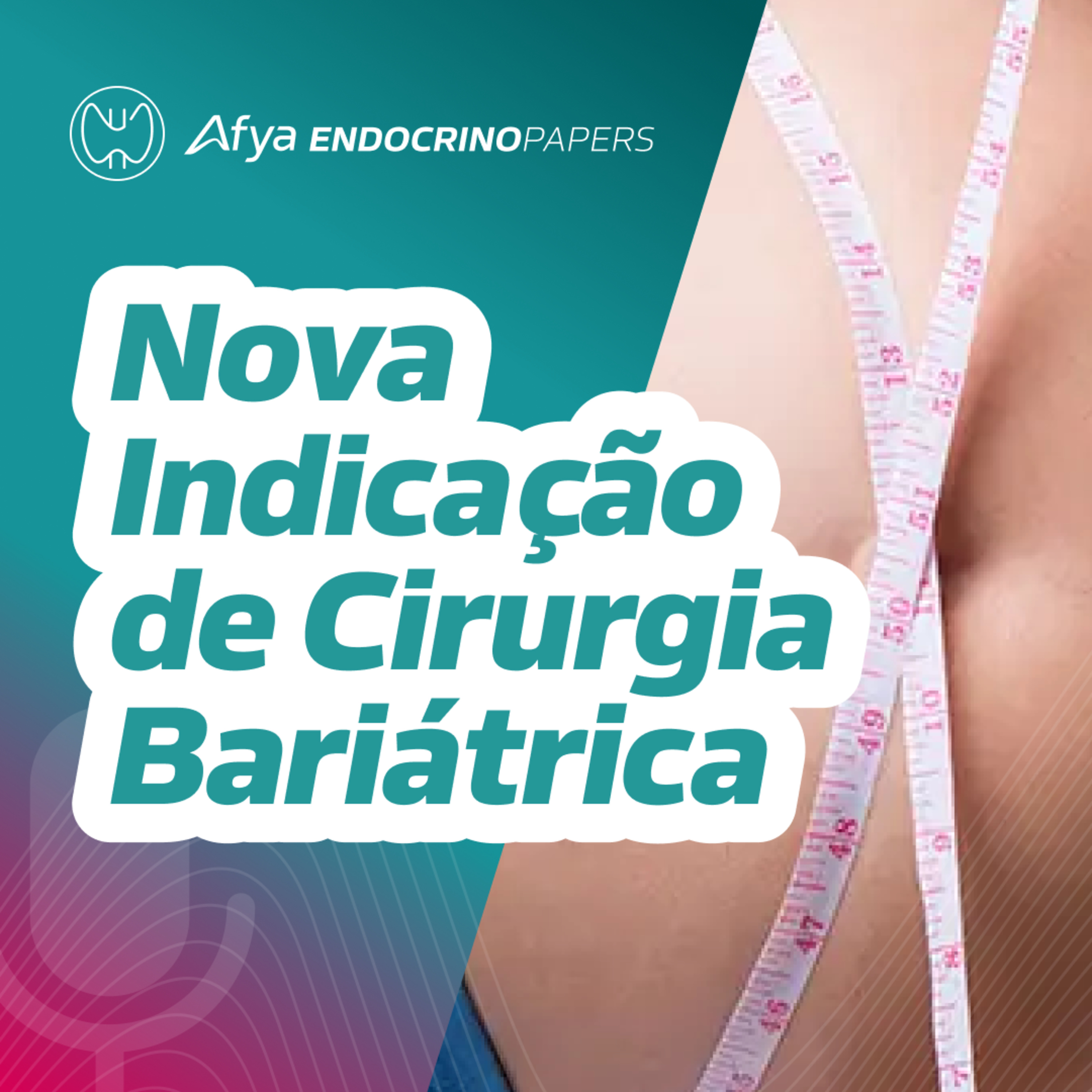 Qual é a nova indicação de cirurgia bariátrica baseada no IMC? episode artwork