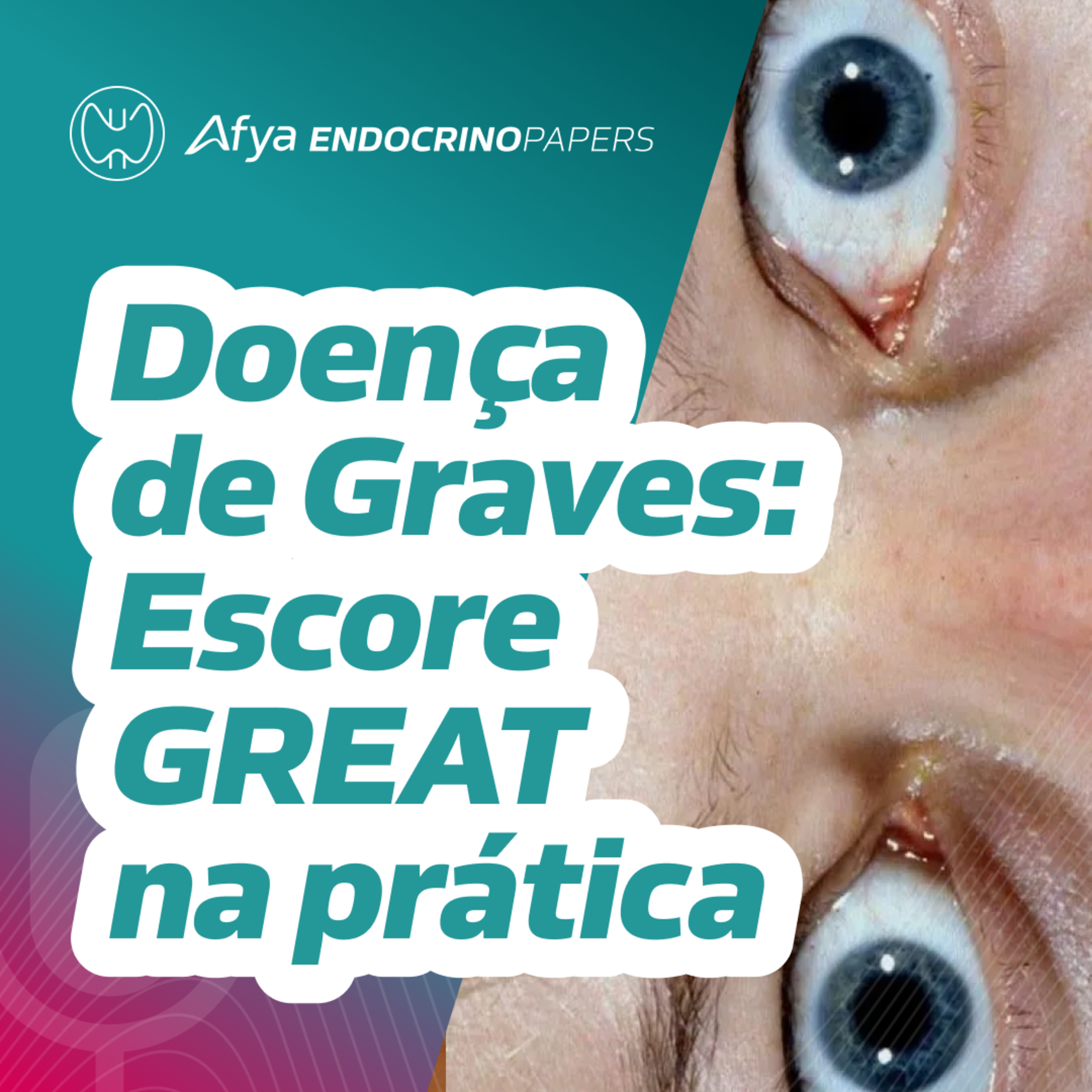 Graves - Como prever quem vai recair após suspensão do tionamidas? episode artwork