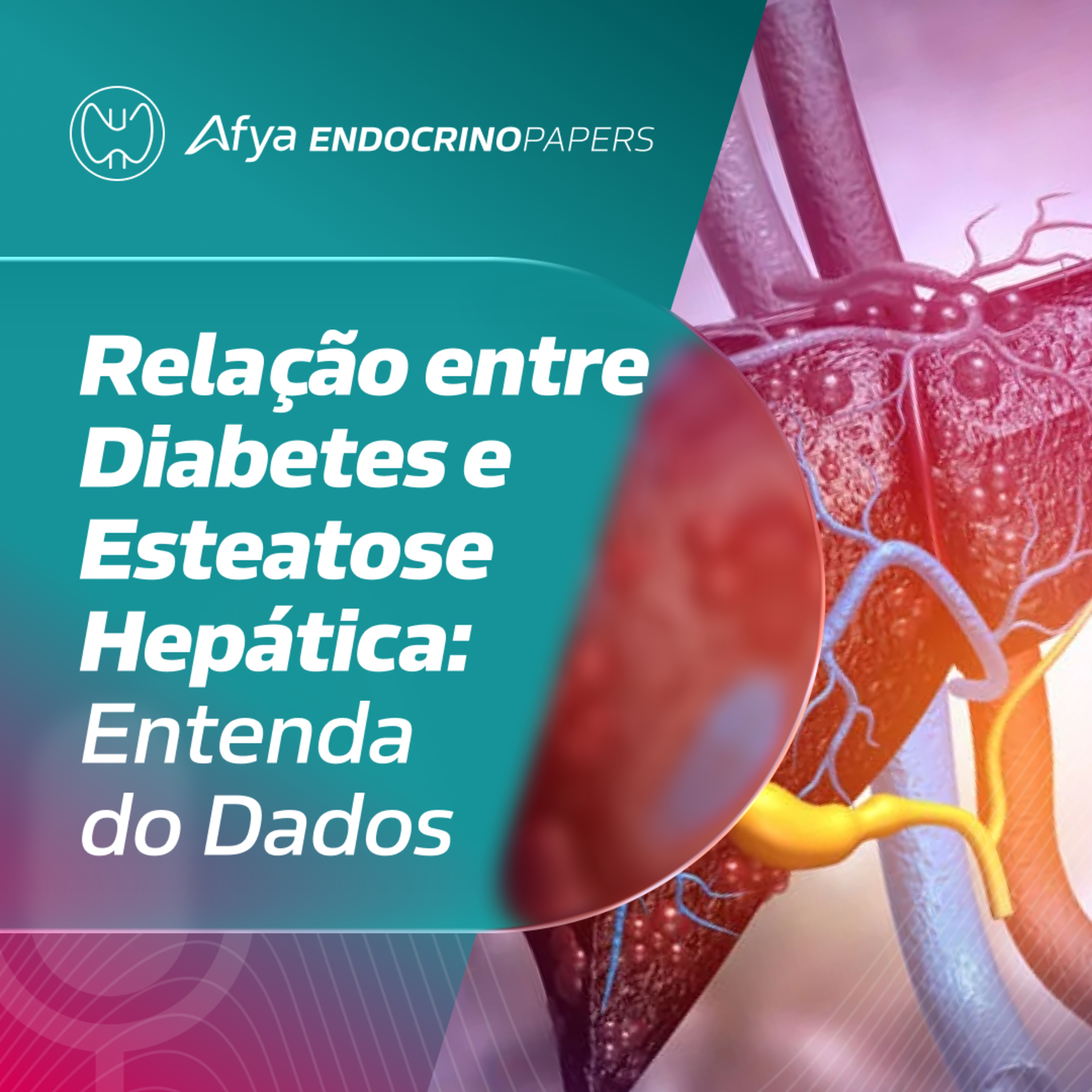 Consenso ADA 2025: qual a relação entre diabetes e MASLD? episode artwork