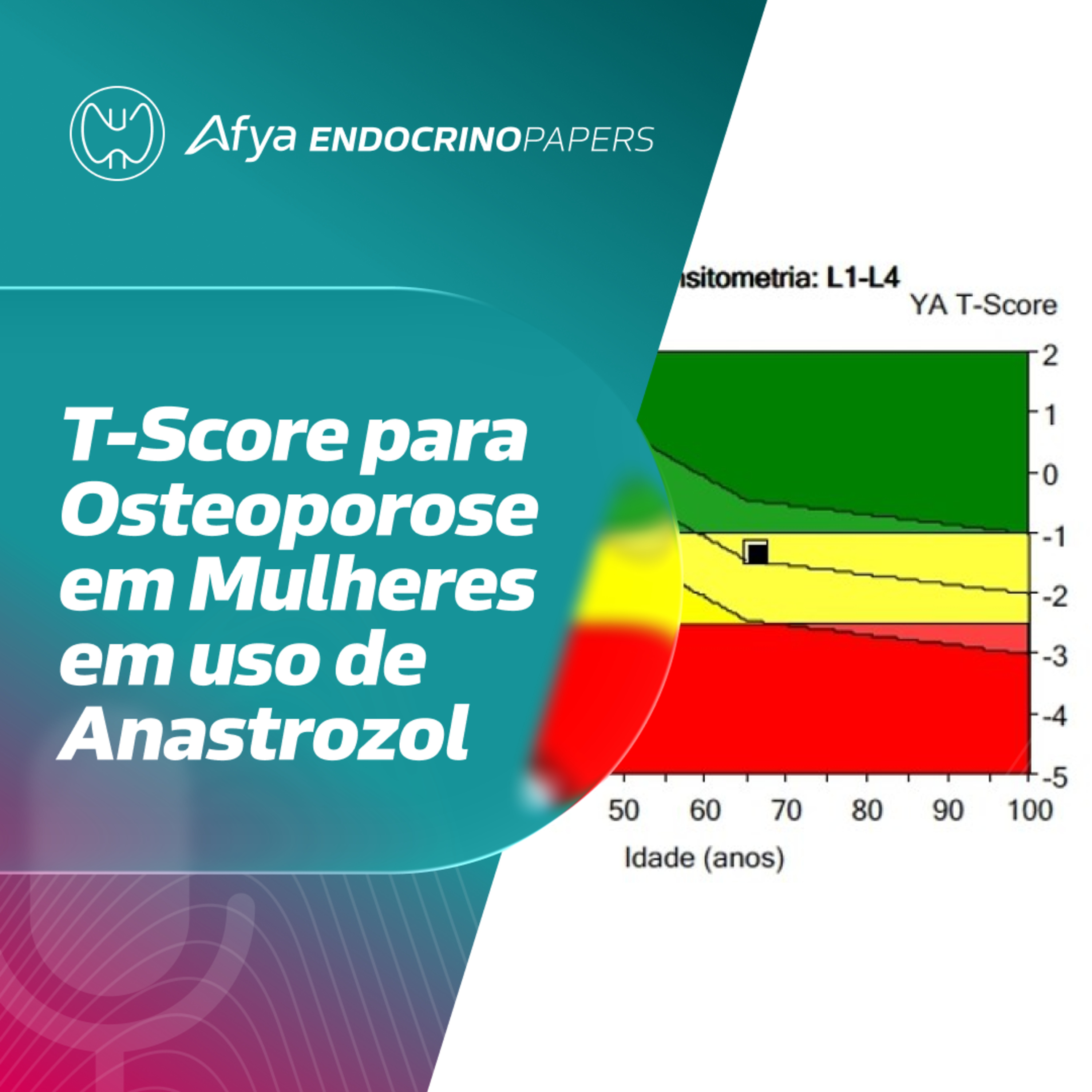 Qual T-Score devo usar para indicar início de tratamento para osteoporose em mulheres em uso de anastrozol? episode artwork