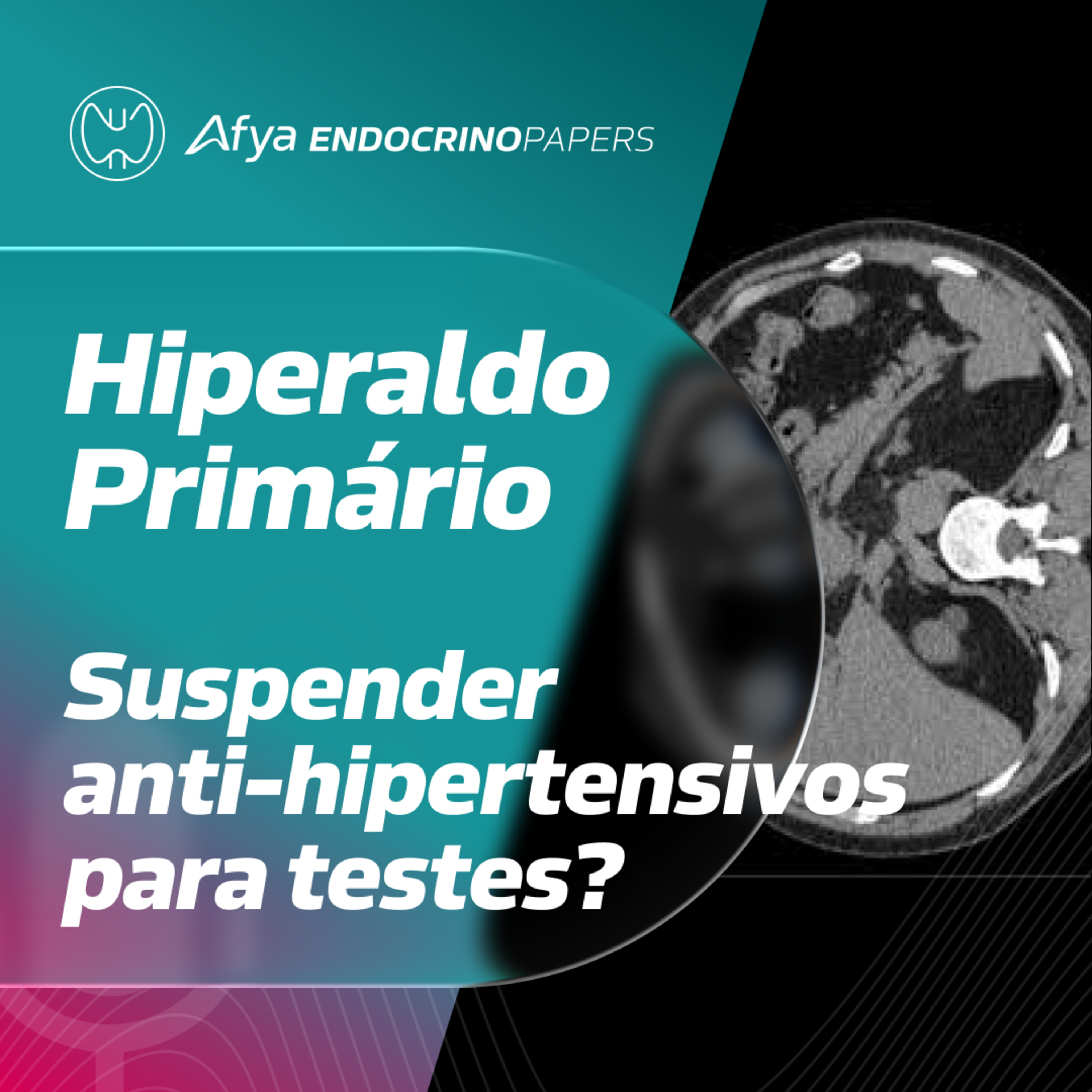 É necessário suspender os anti-hipertensivos para rastrear o hiperaldosteronismo primário? episode artwork