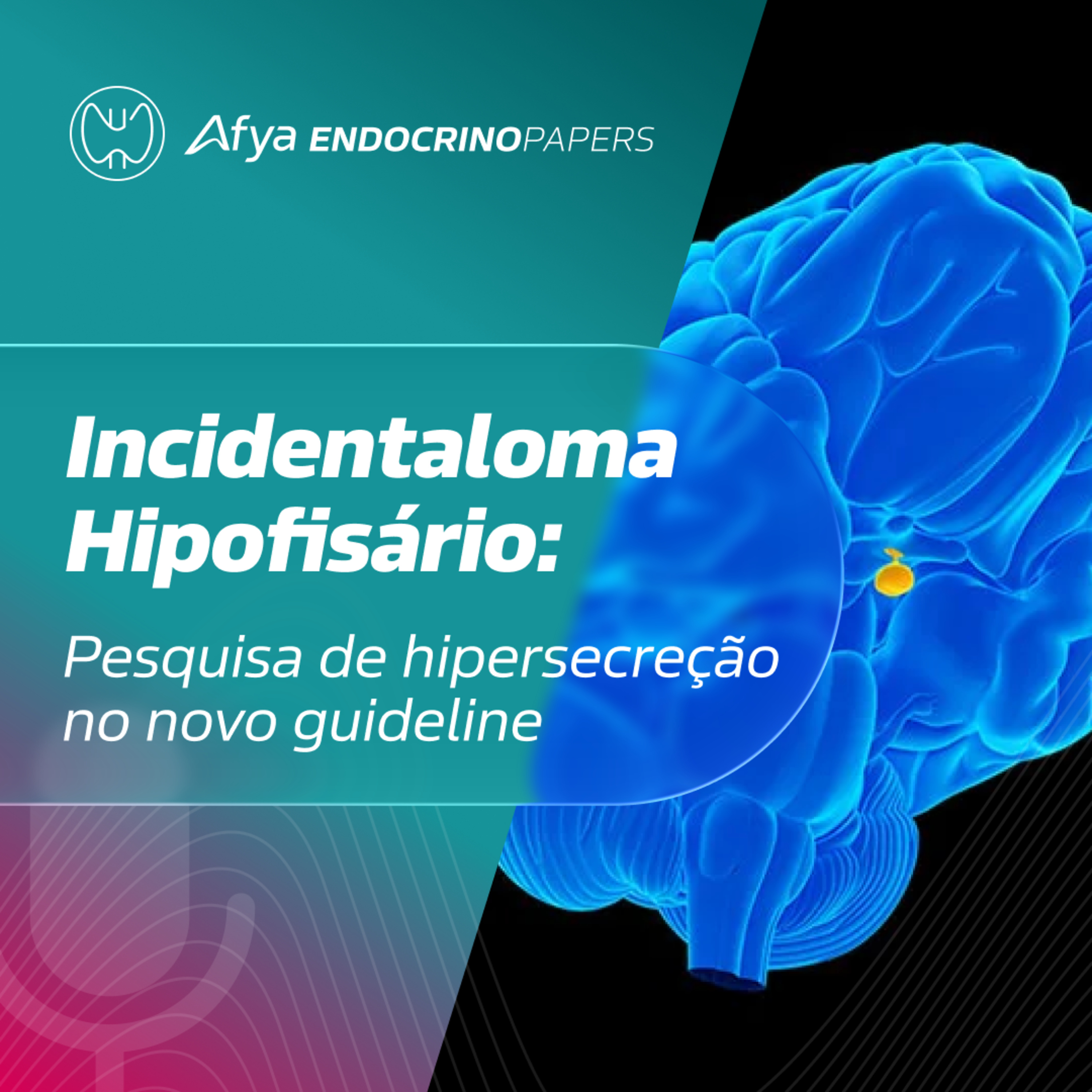 Quando e como avaliar hipersecreção hormonal nos incidentalomas hipofisários segundo o novo guideline? episode artwork