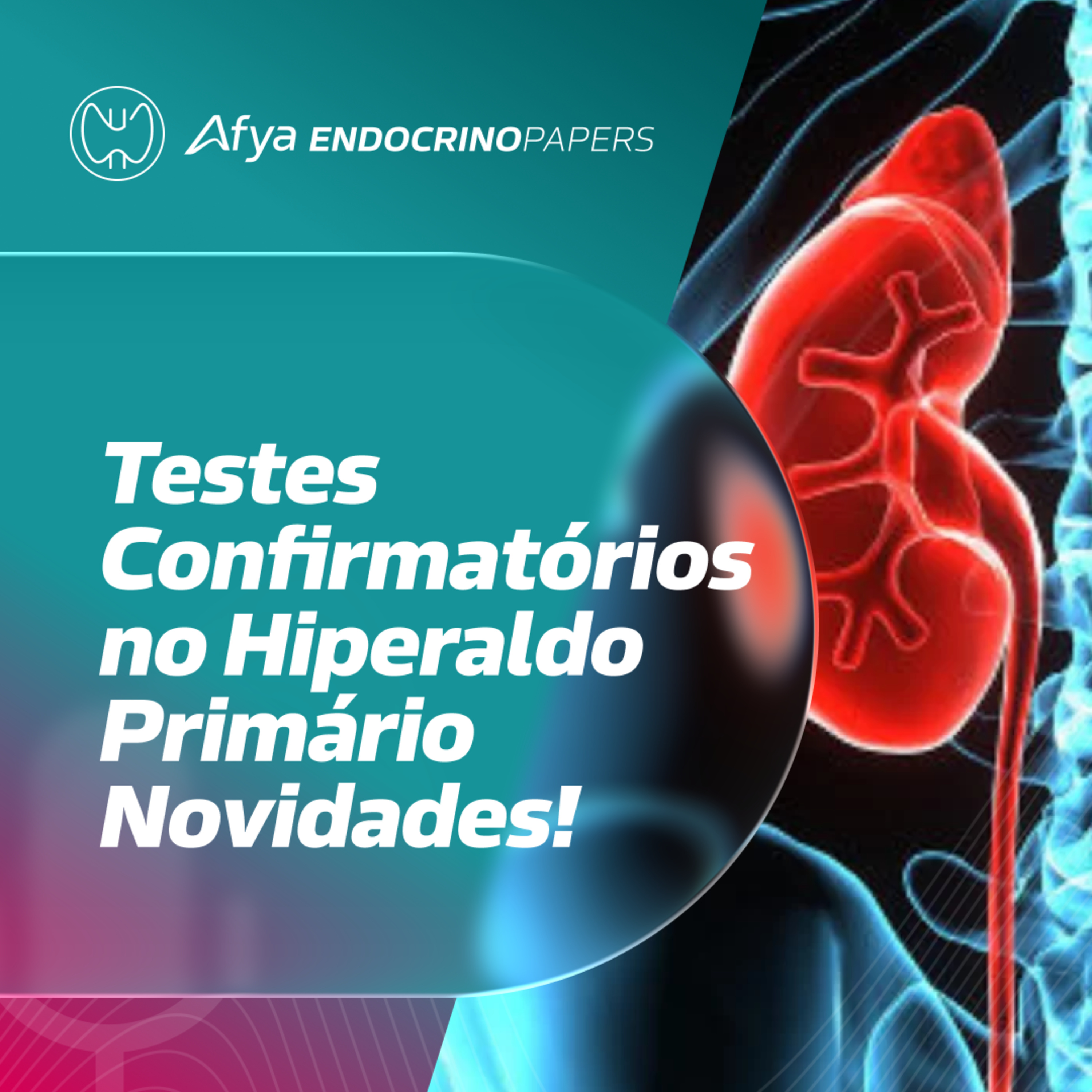 O que mudou em relação aos testes confirmatórios do hiperaldosteronismo primário?  episode artwork