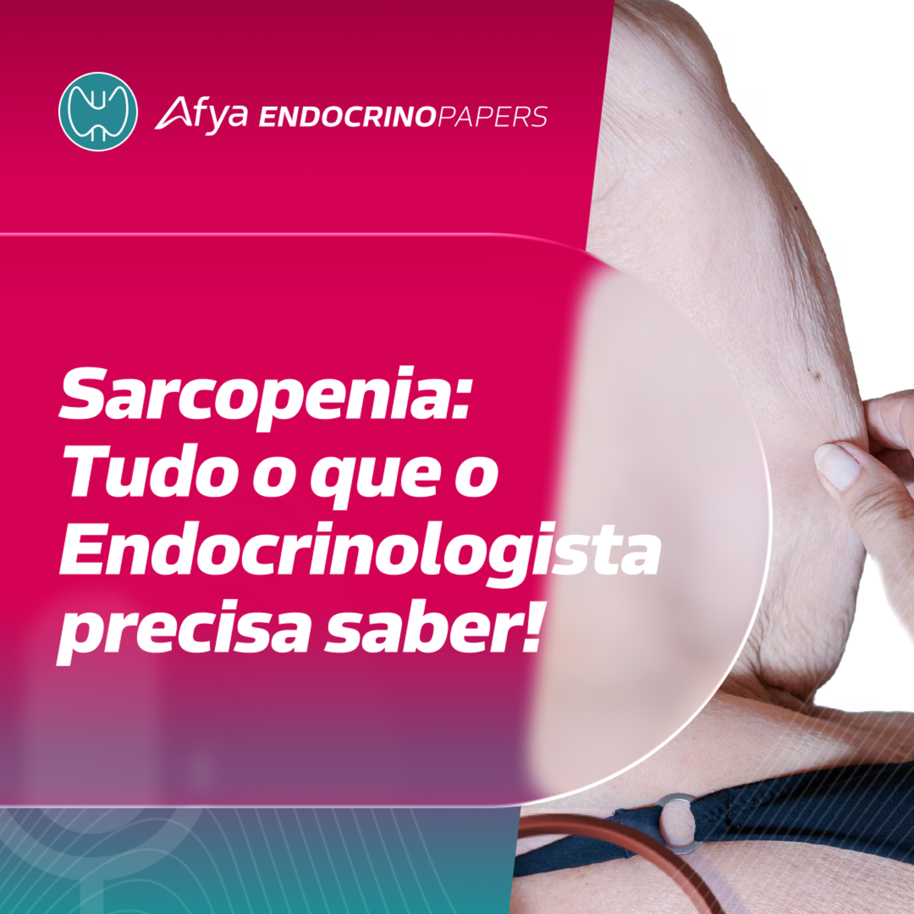 Sarcopenia: tudo o que o endocrinologista precisa saber