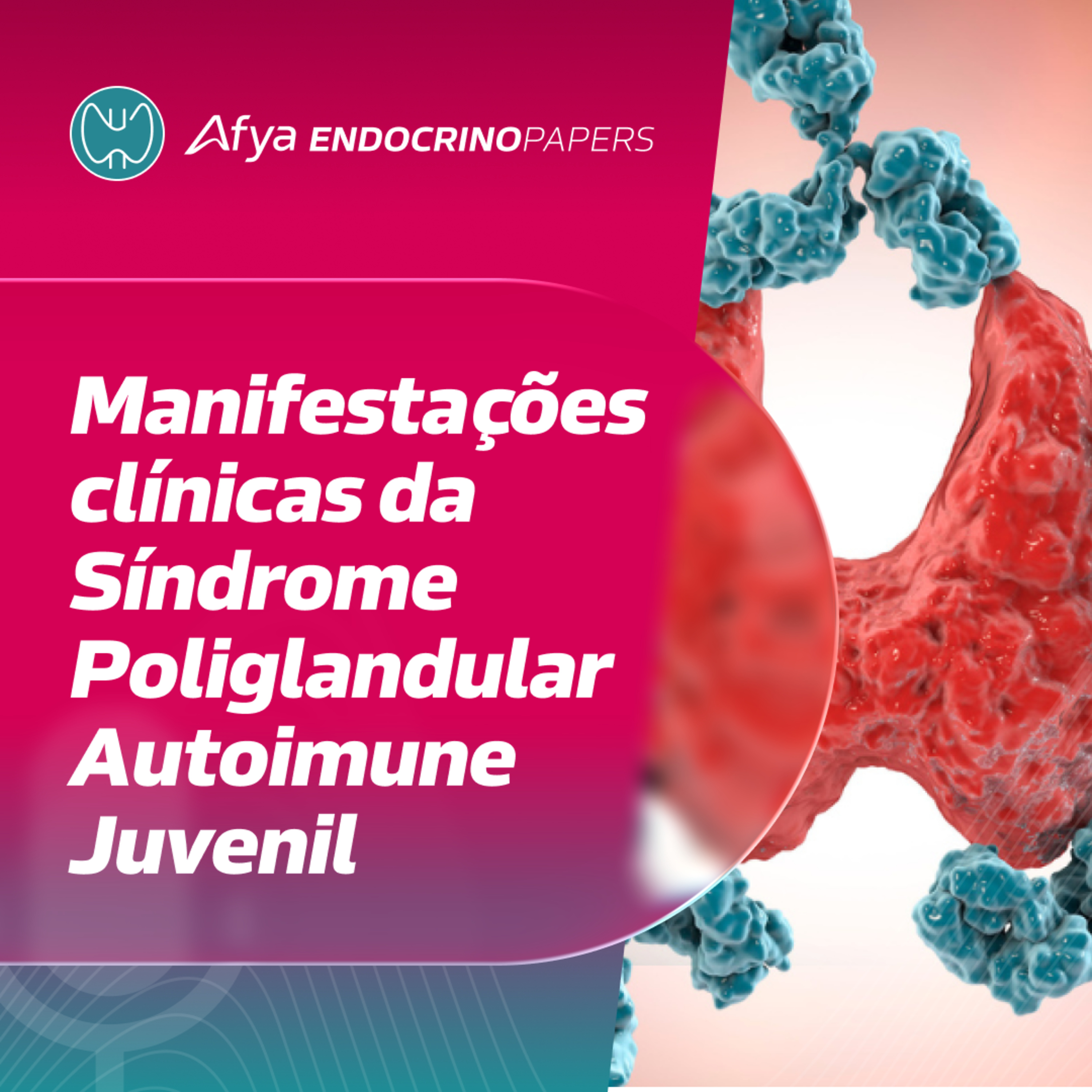 Quais são as manifestações clínicas da síndrome poliglandular autoimune juvenil? episode artwork