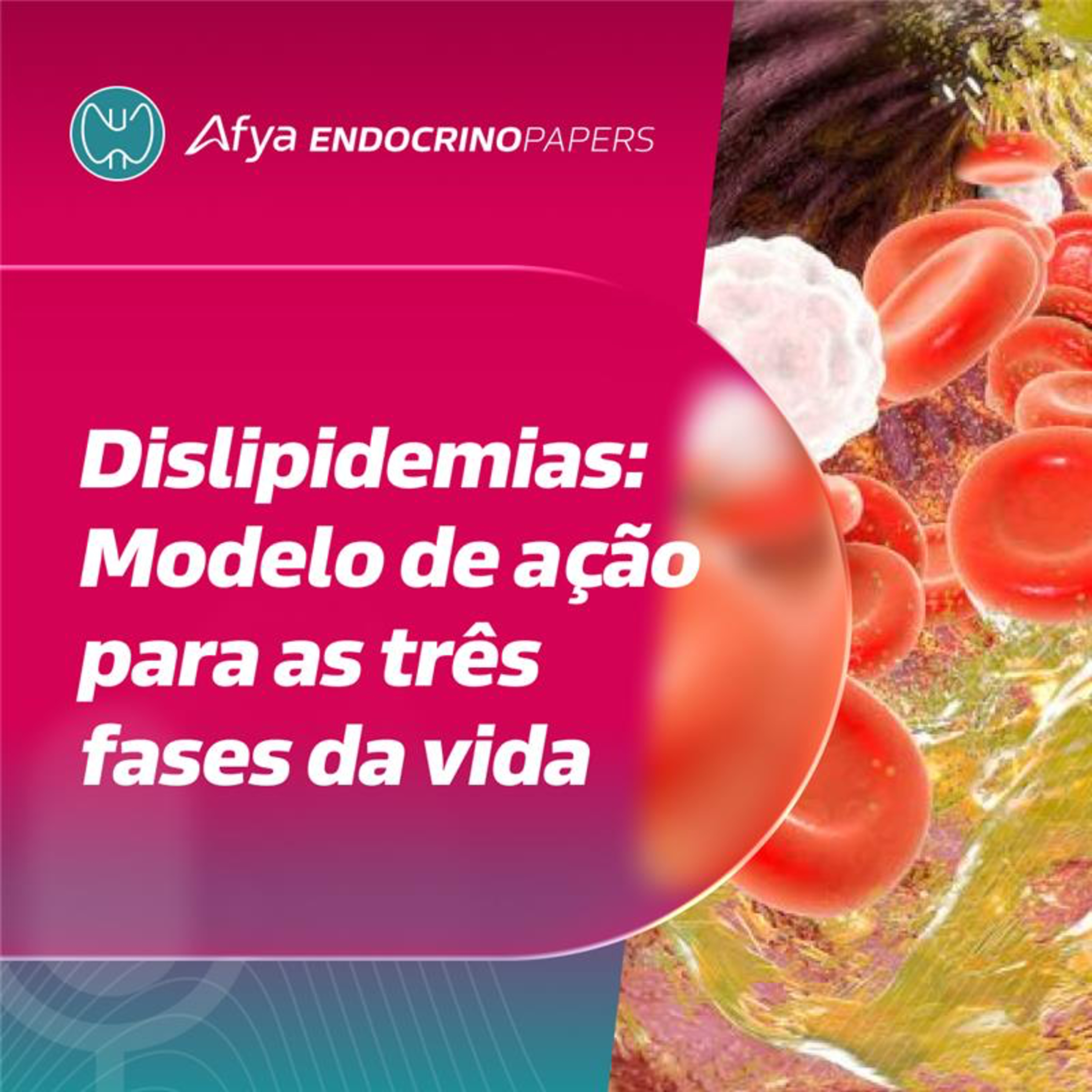 A nova diretriz de dislipidemias apresenta modelo de ação para as três fases da vida episode artwork