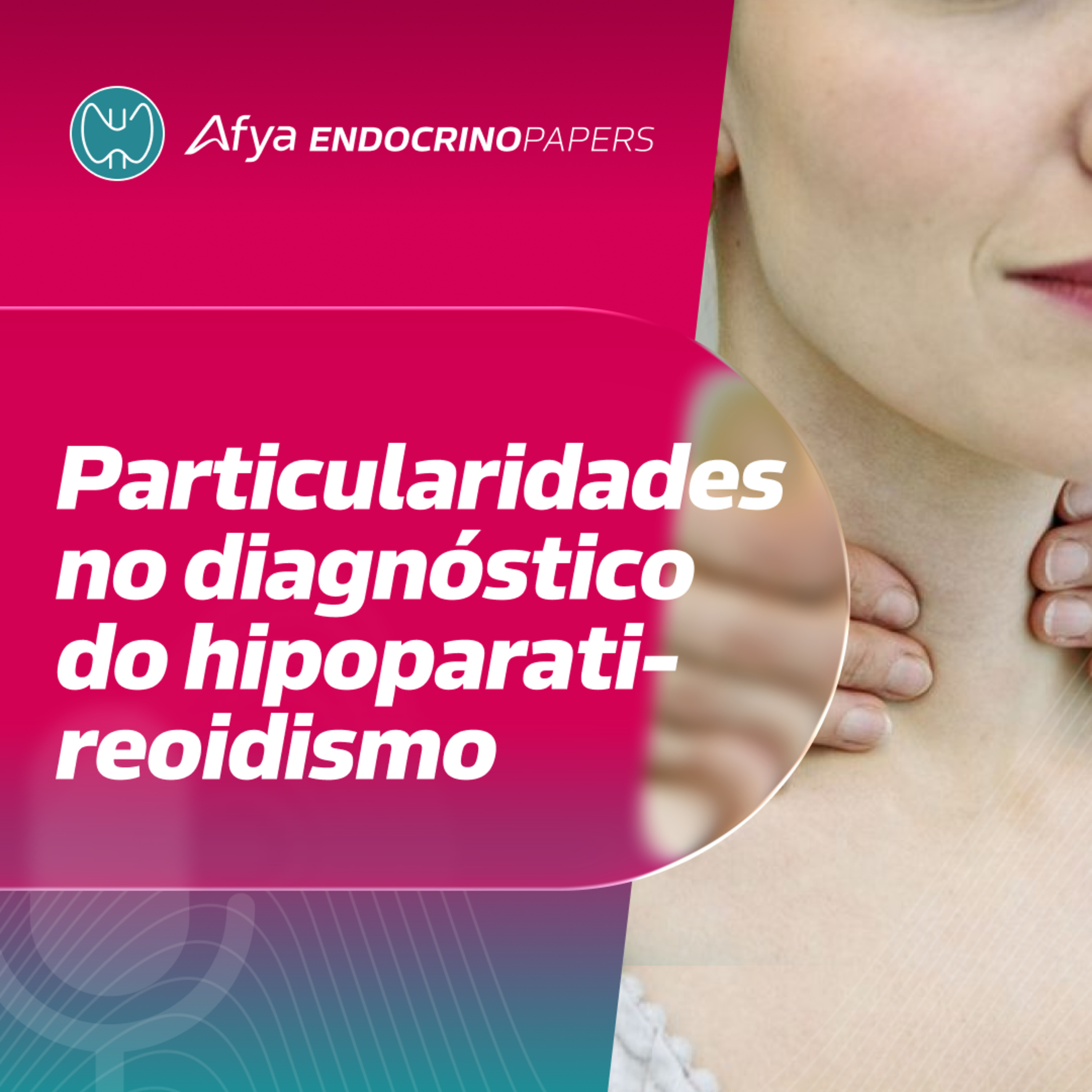 Diagnóstico de hipoparatireoidismo – orientações do novo guideline europeu episode artwork