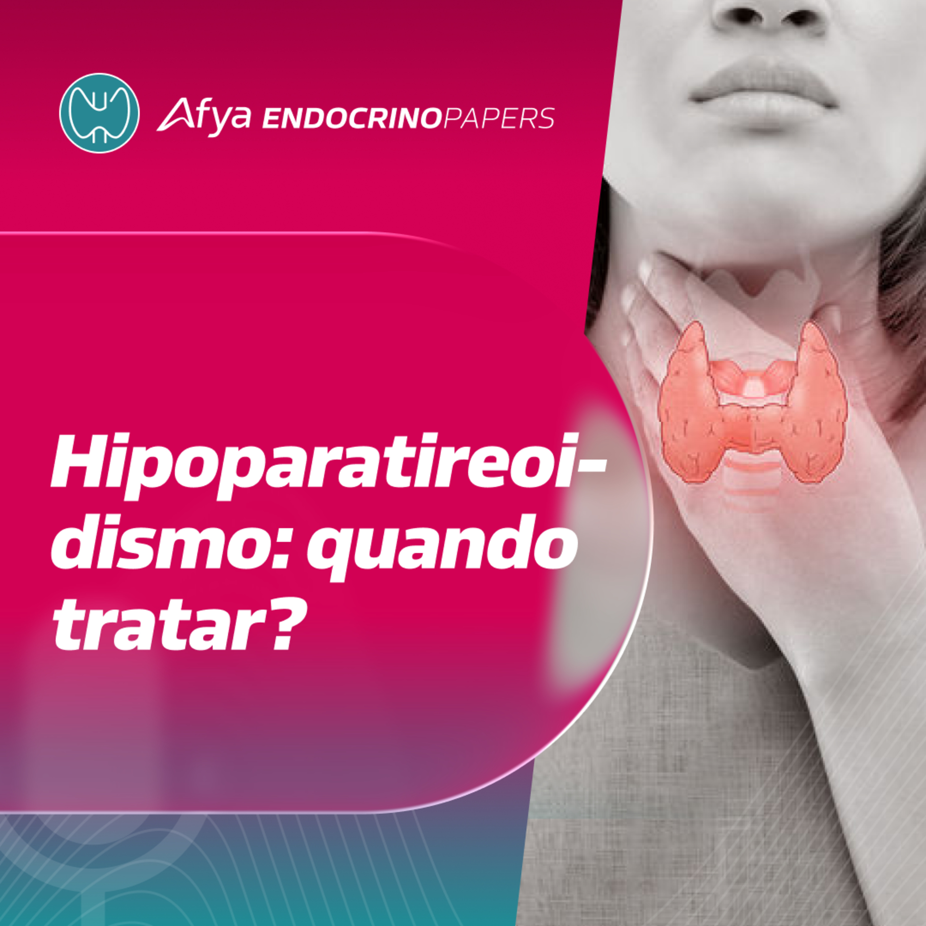 Quando deve ser tratado o hipoparatireodisimo de acordo com o guideline europeu?  episode artwork