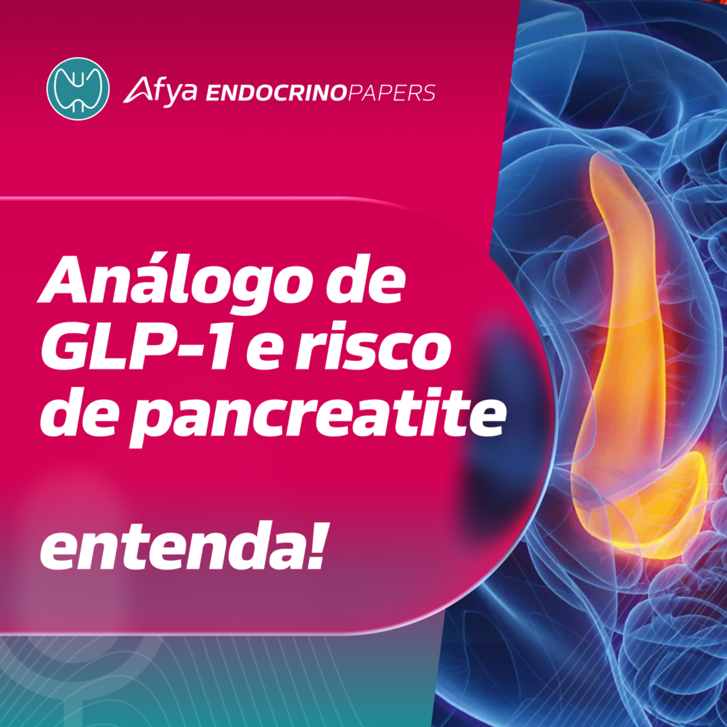 É verdade que o uso de análogo de GLP-1 aumenta o risco de pancreatite? episode artwork