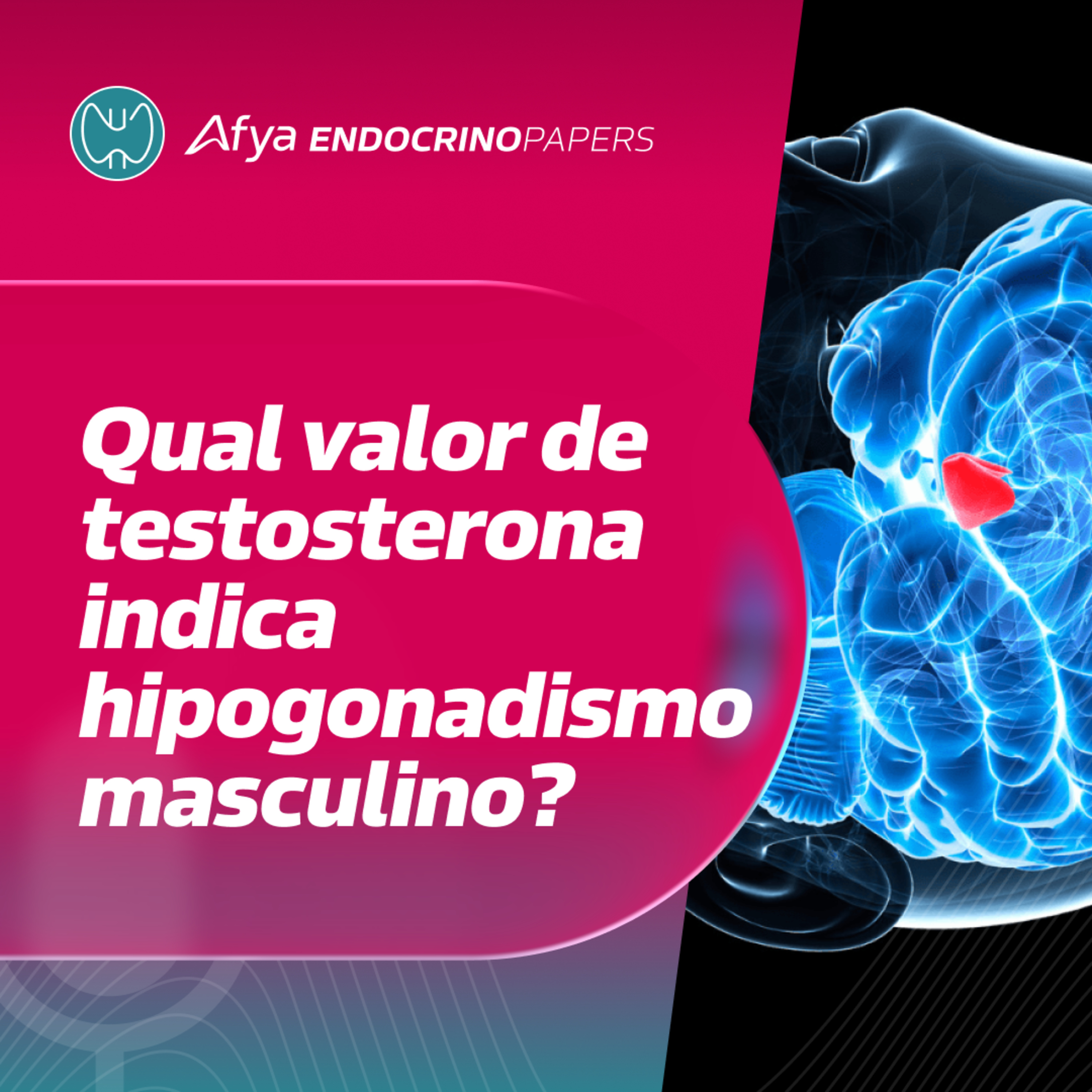 Diretriz: qual é o ponto de corte da testosterona para diagnóstico de hipogonadismo masculino? episode artwork