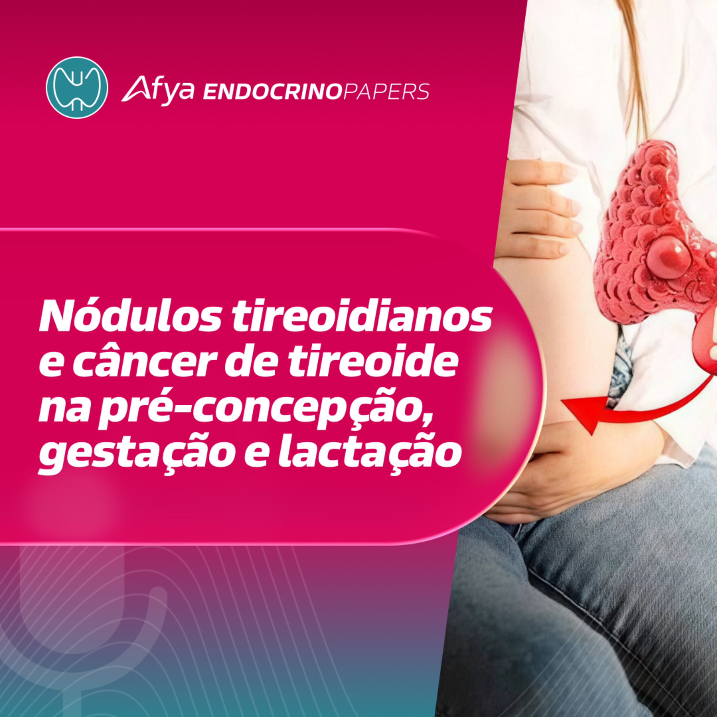 Nódulos tireoidianos e câncer de tireoide na pré-concepção, gestação e lactação episode artwork