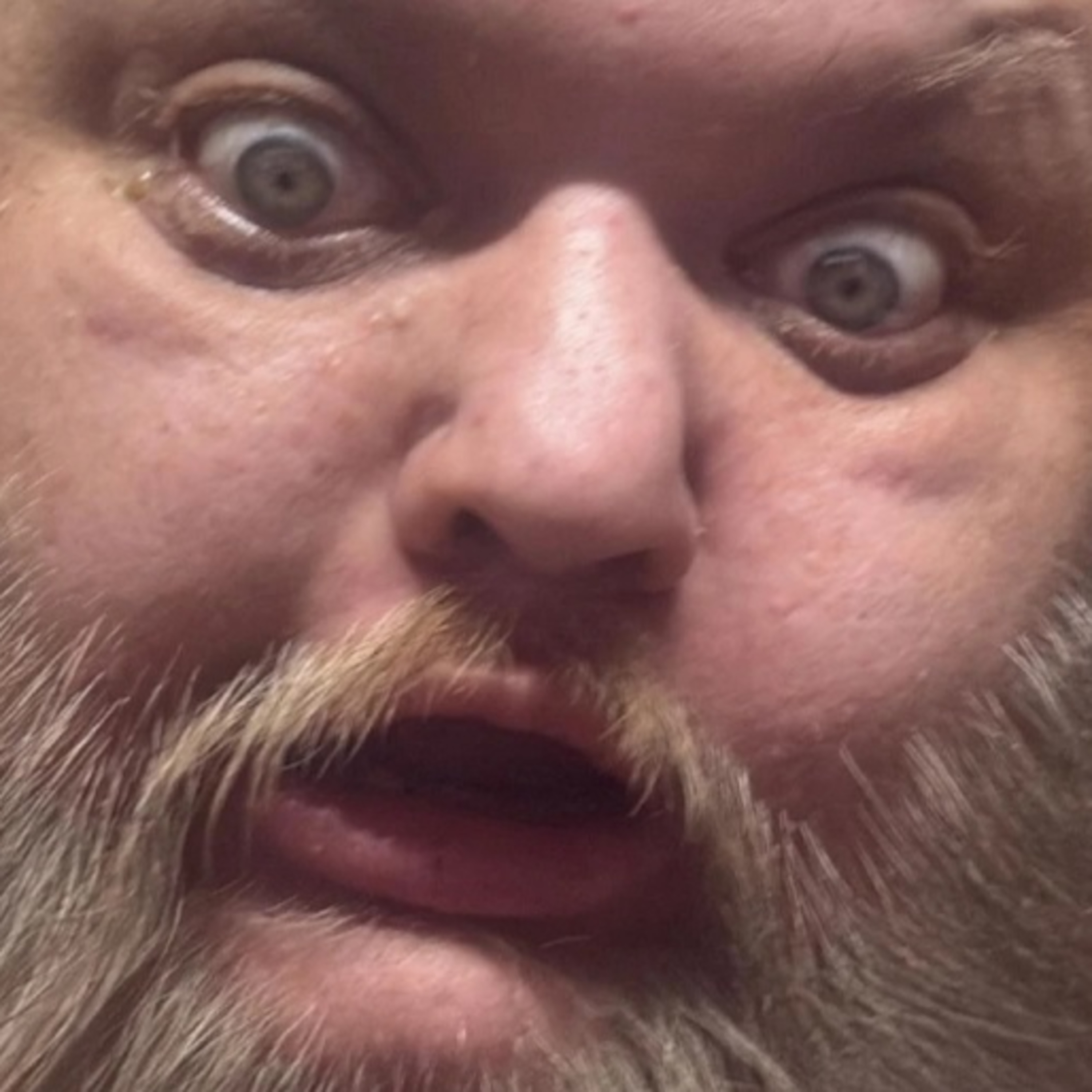 Brett Keane Talks King Cobra Death and Apology for PimpmunkX AKA KingNeckBeard #rip episode artwork