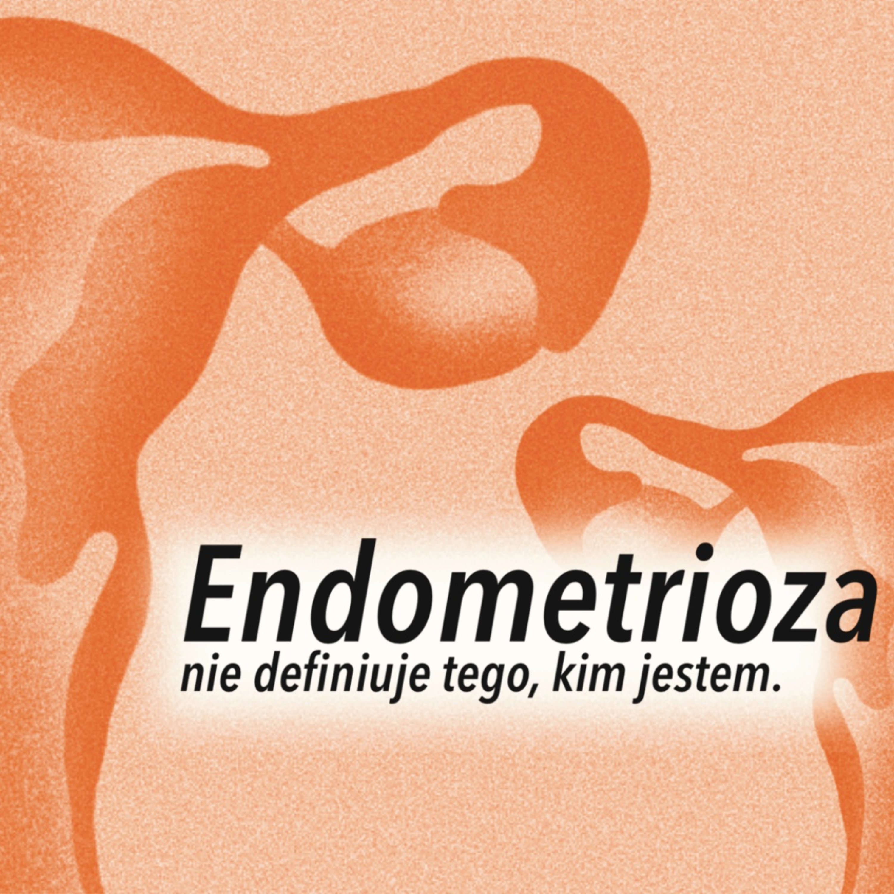 Endometrioza nie definiuje tego, kim jestem  episode artwork