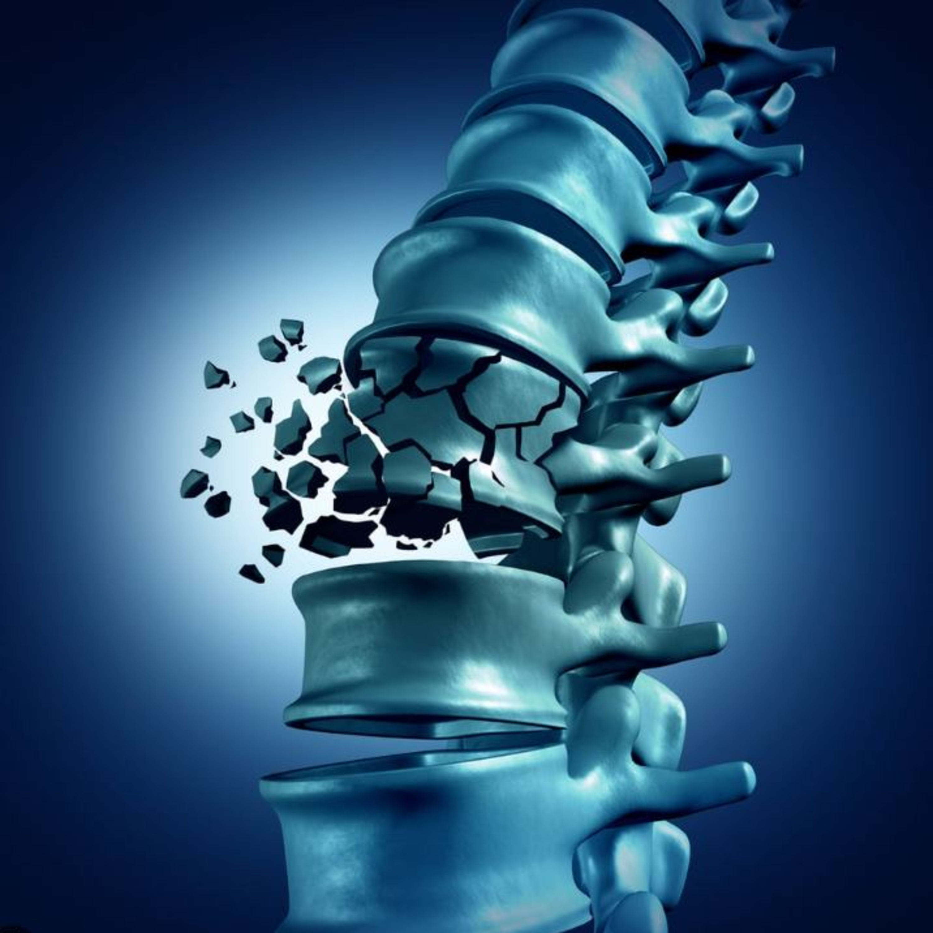 Spinal Cord Injuries episode artwork