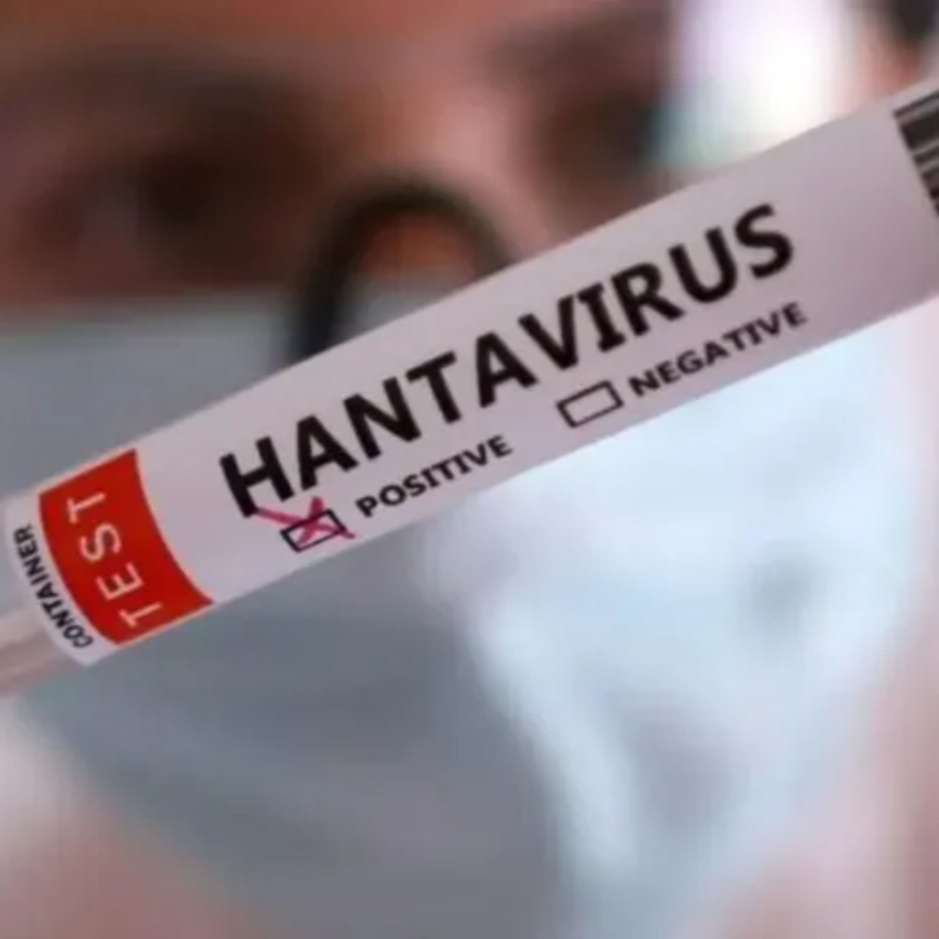 Resultados preliminares de laboratorio sobre un spray nasal que tiene eficiencia antiviral contra el Hantavirus - Andrea Dugour episode artwork