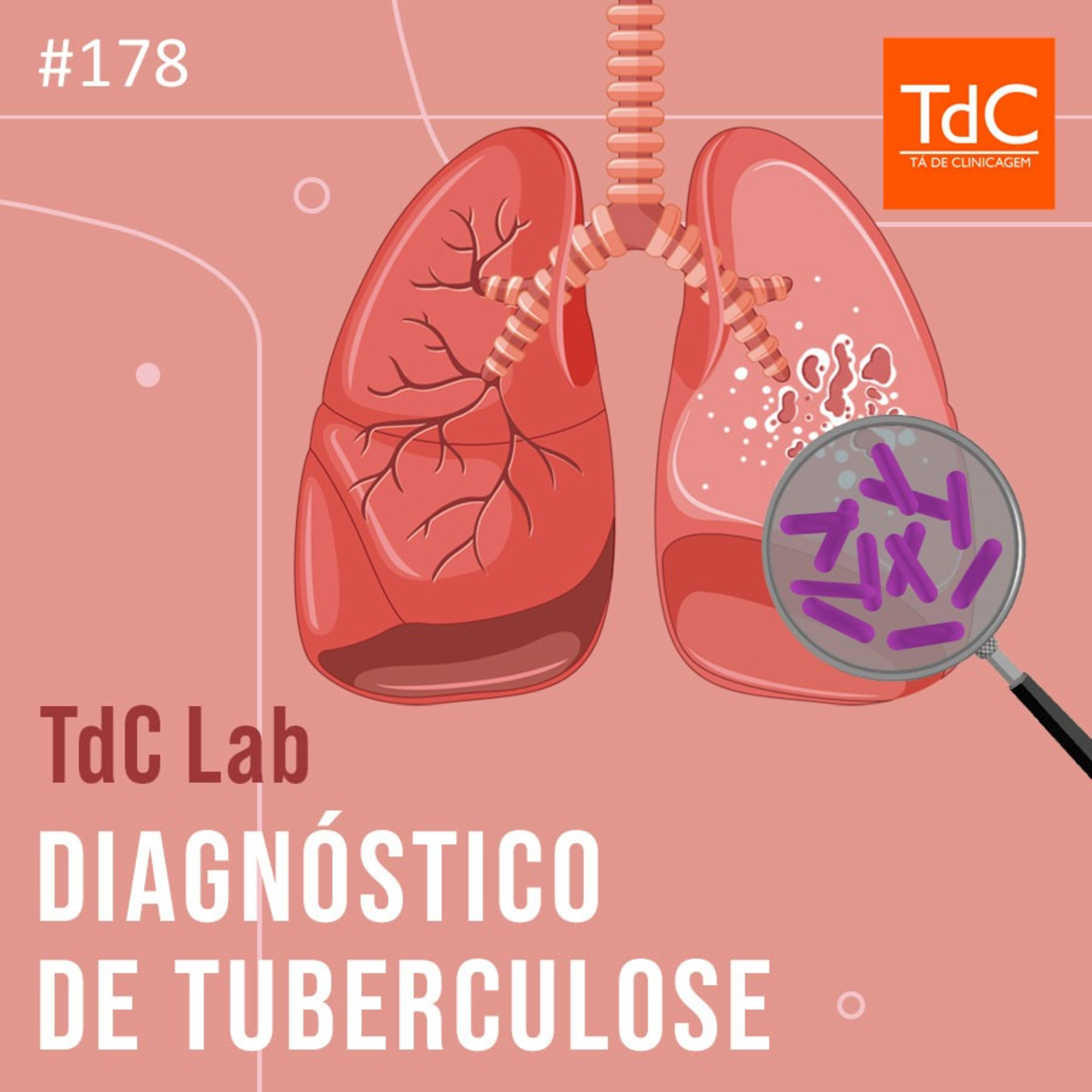 Episódio 178 TdC Lab Diagnóstico de Tuberculose TdC