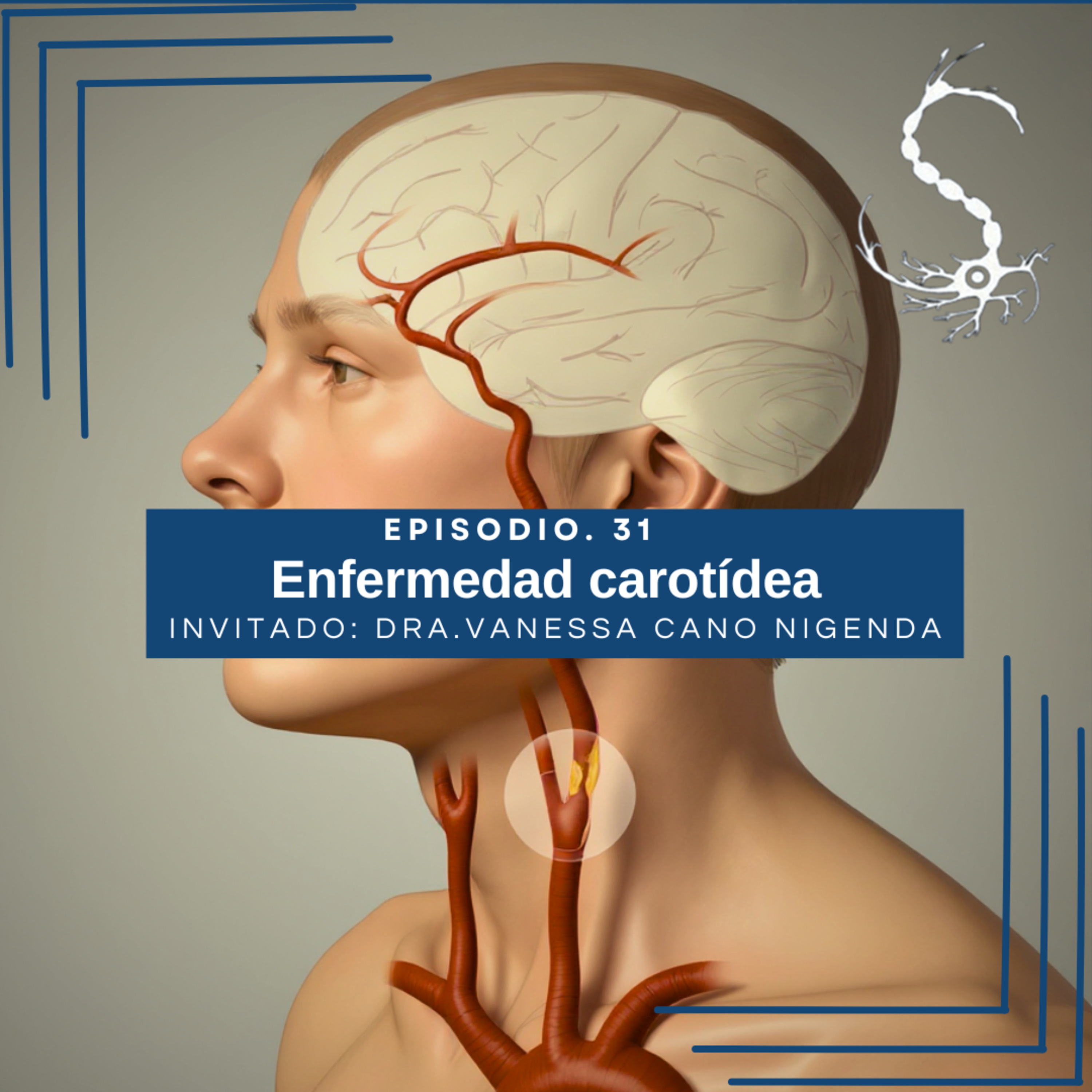 SINNNapsis - T1 Neurología