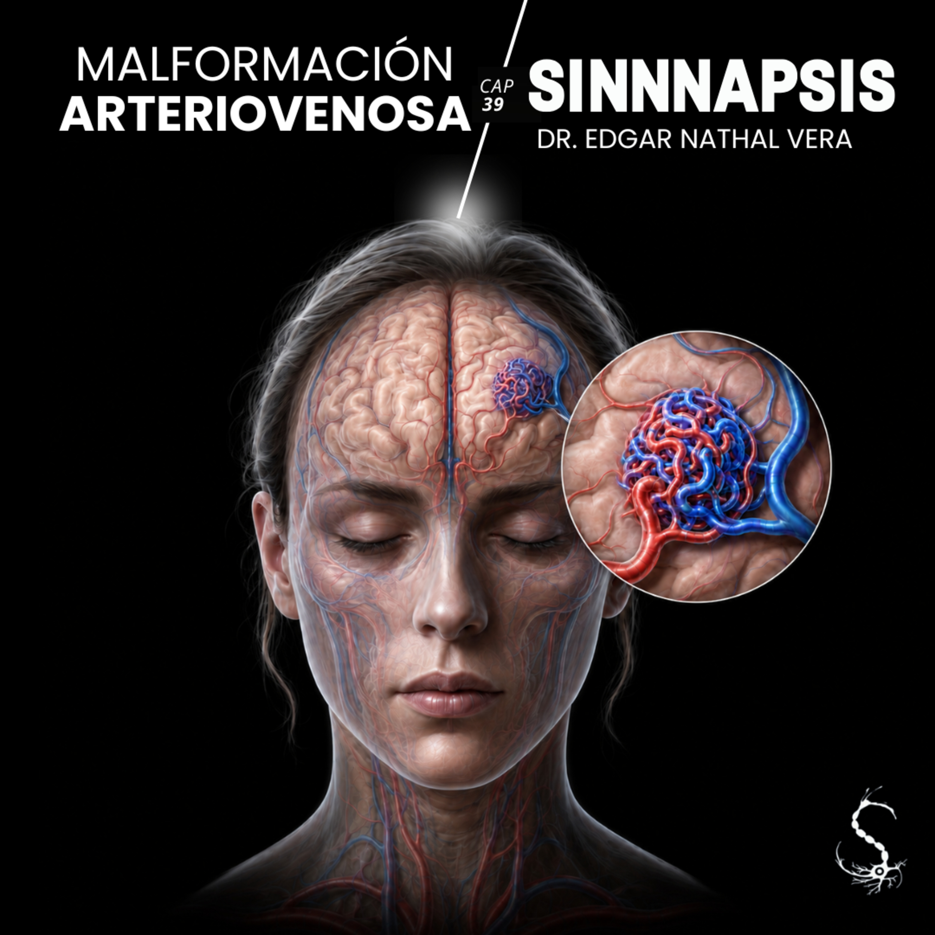 39. Malformación Arteriovenosa episode artwork